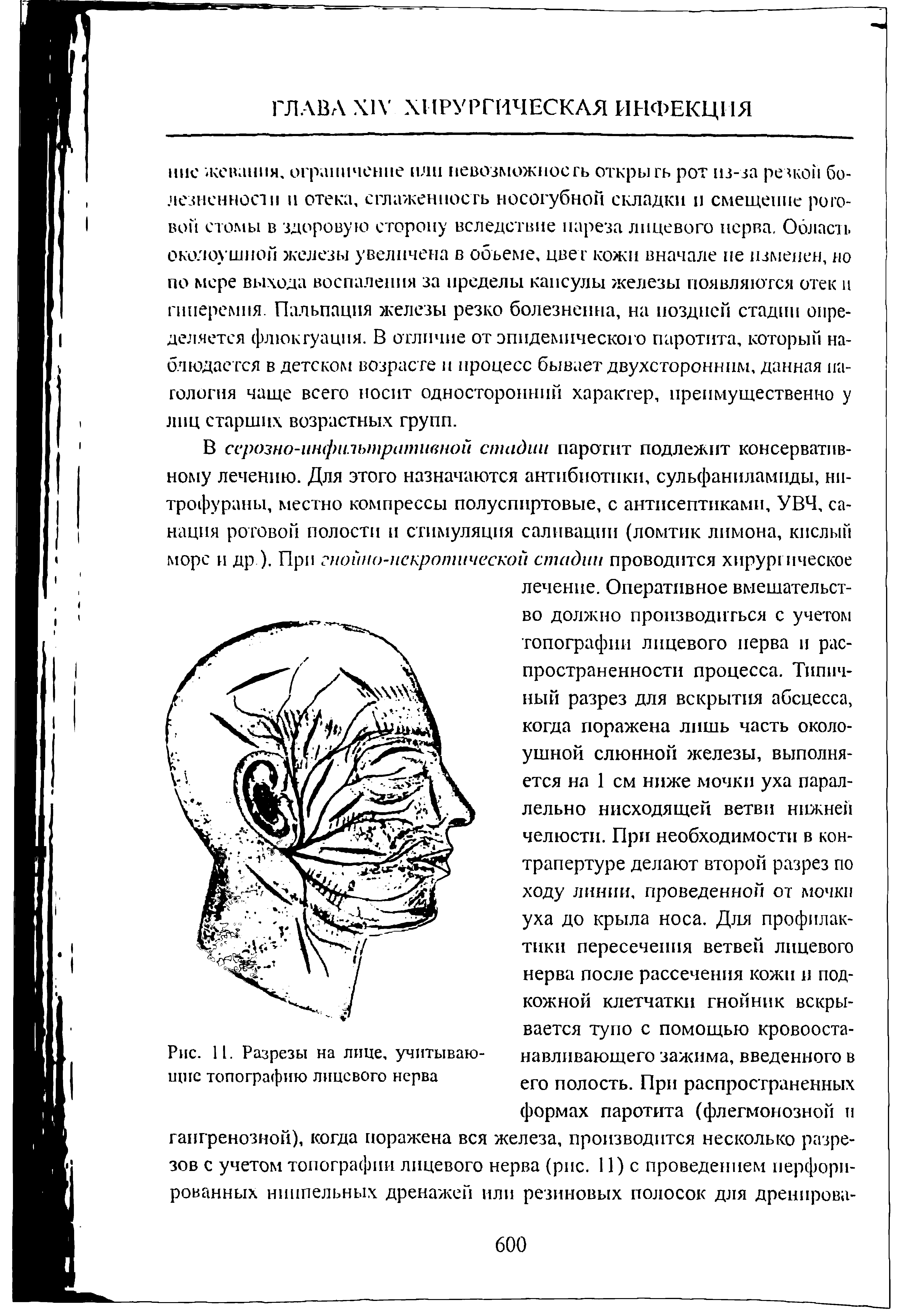 Рис. 11. Разрезы на лице, учитывающие топографию лицевого нерва...