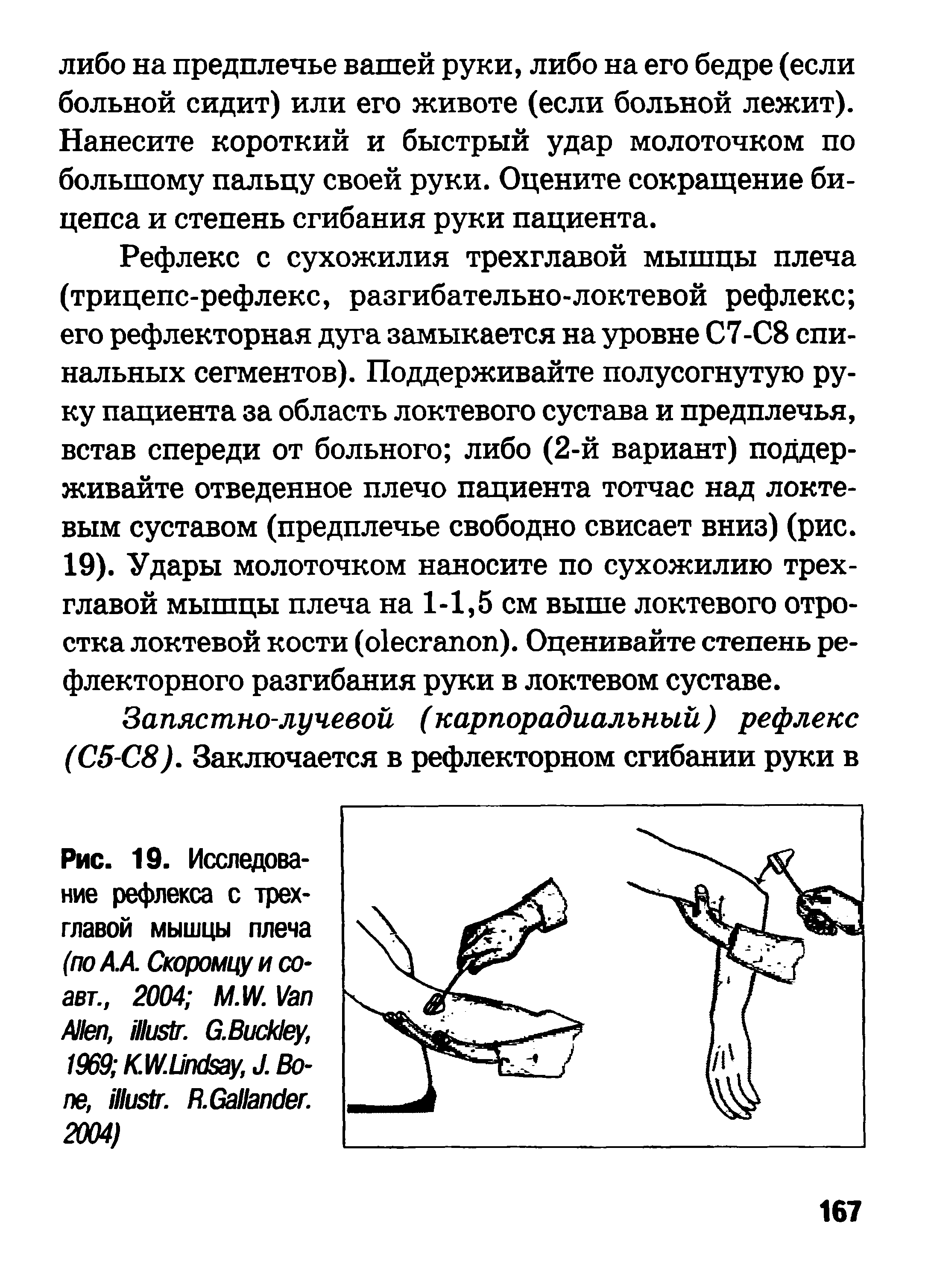 Рис. 19. Исследование рефлекса с трехглавой мышцы плеча (по А. А. Скоромцу и со-авт., 2004 M.W.V A , . G.B , 1969 KW.U , J. B , . R.G . 2004)...