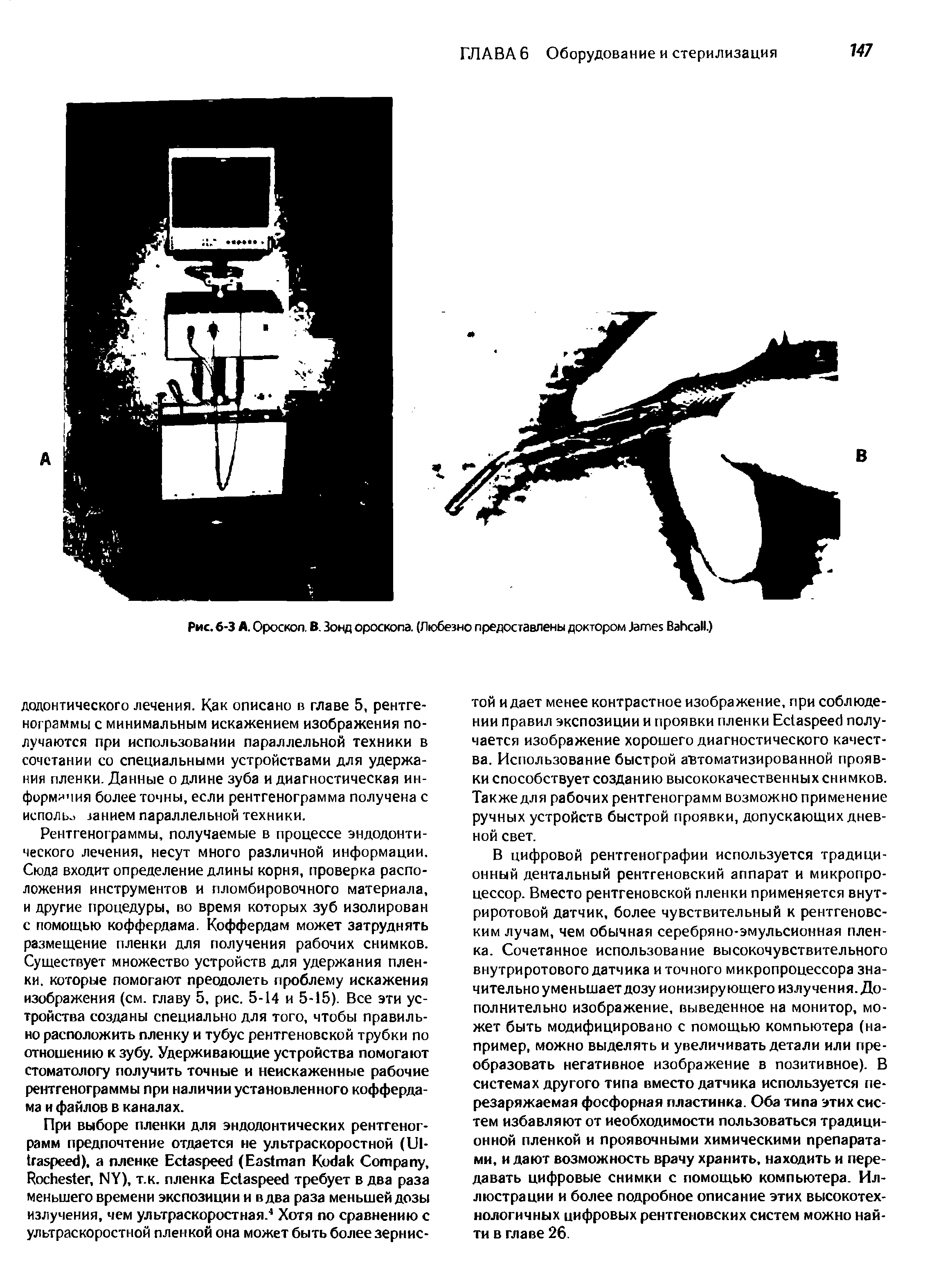 Рис. 6-3 А. Ороскоп. В. Зонд ороскопа. (Любезно предоставлены доктором J B .)...