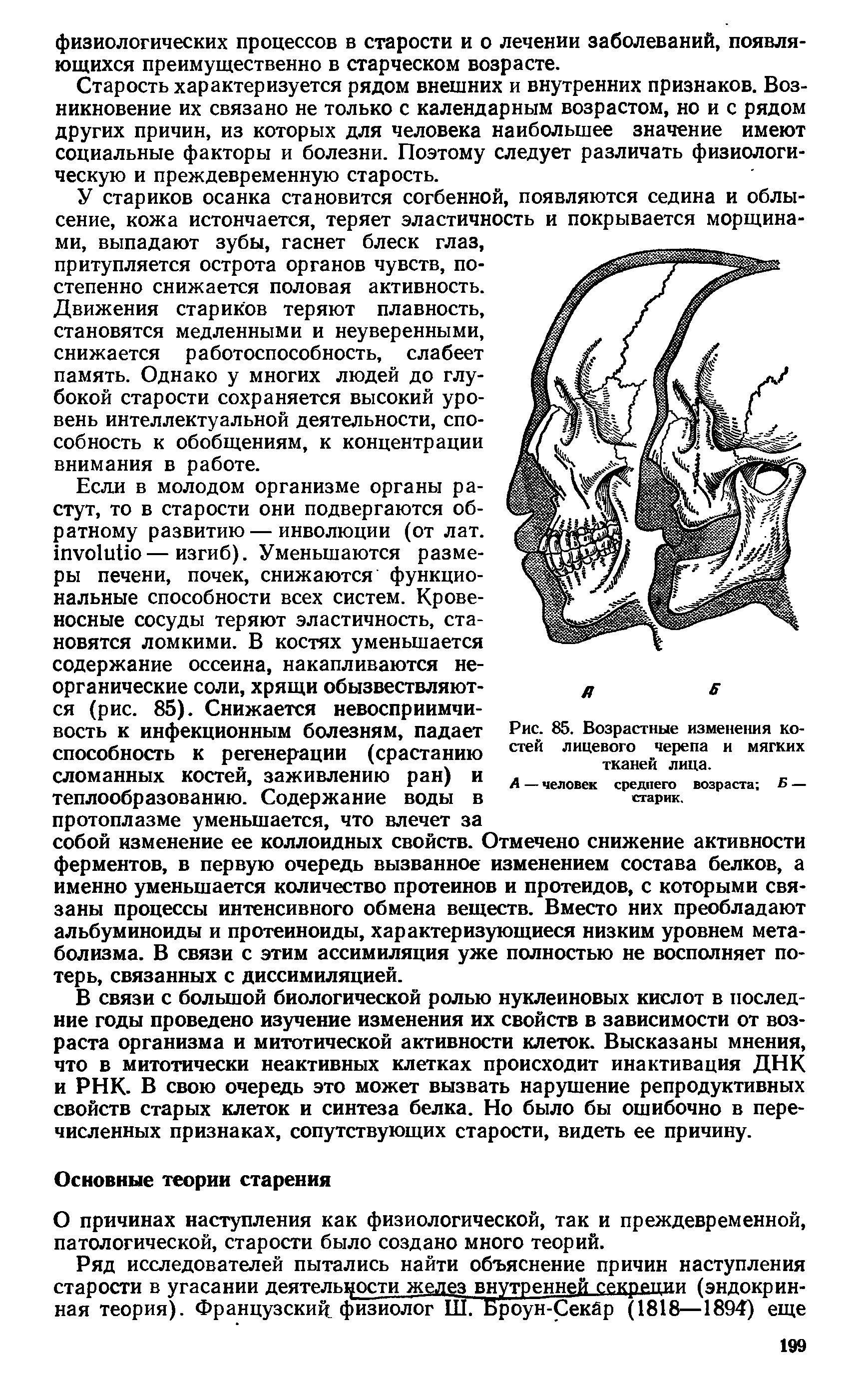 Рис. 85. Возрастные изменения костей лицевого черепа и мягких тканей лица.