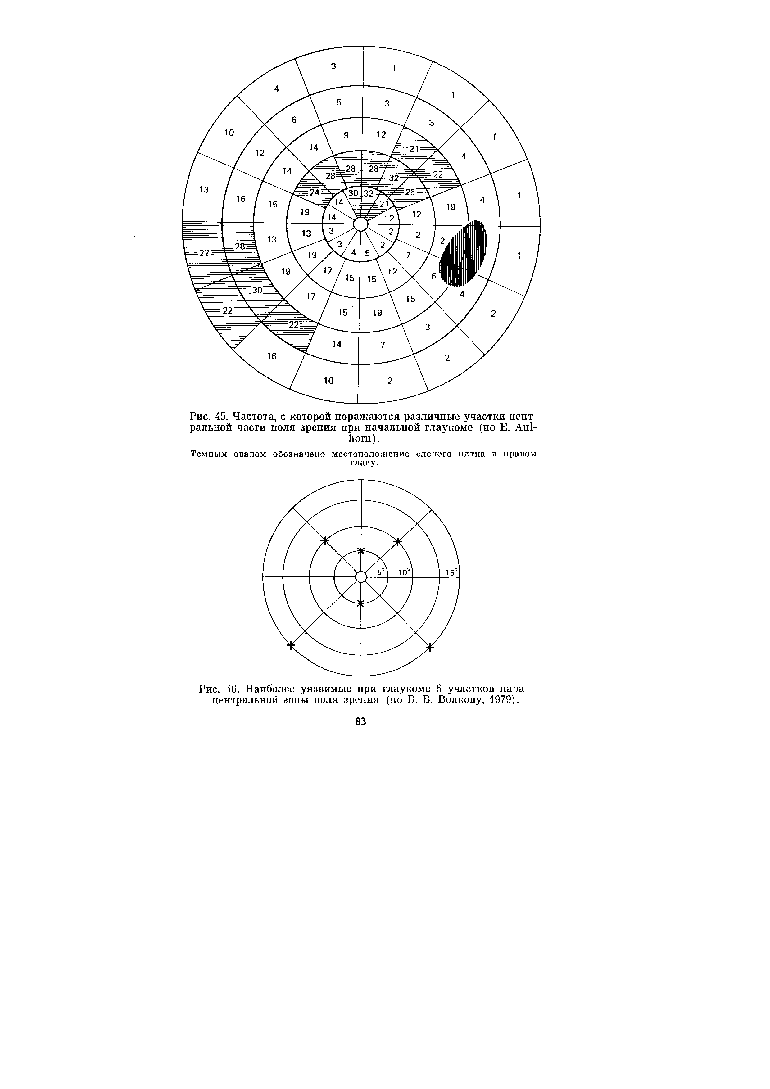 Рис. 46. Наиболее уязвимые при глаукоме 6 участков парацентральной зоны поля зрения (по В. В. Волкову, 1979).