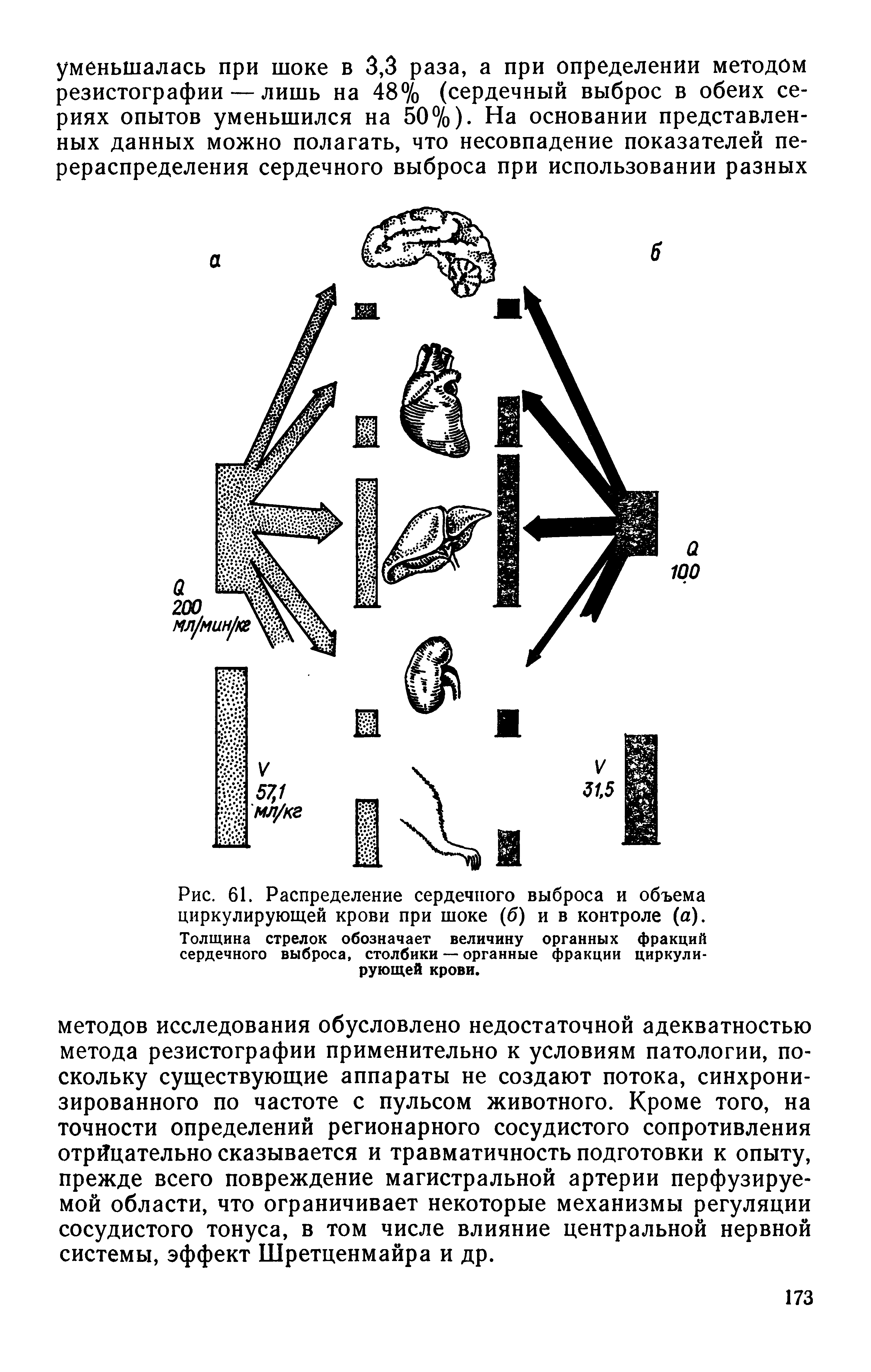 Рис. 61. Распределение сердечного выброса и объема циркулирующей крови при шоке (б) и в контроле (а). Толщина стрелок обозначает величину органных фракций сердечного выброса, столбики — органные фракции циркулирующей крови.