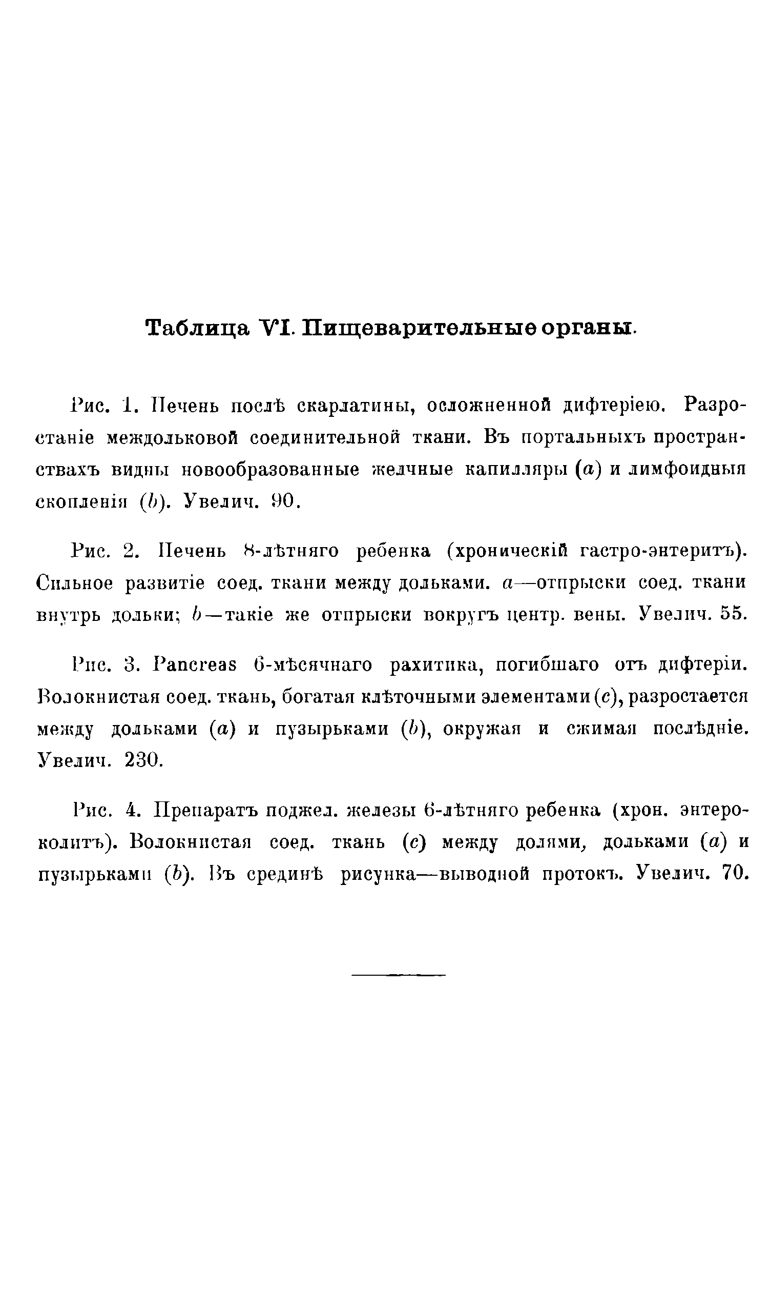 Рис. 1. Печень посл-Ь скарлатины, осложненной дифтер1ею. Разро-CT H междольковой соединительной ткани. Въ портальныхъ простран-ствахъ видны новообразованные желчные капилляры (а) и лимфоидныя скоплен1я (Ь). Увелич. 90.