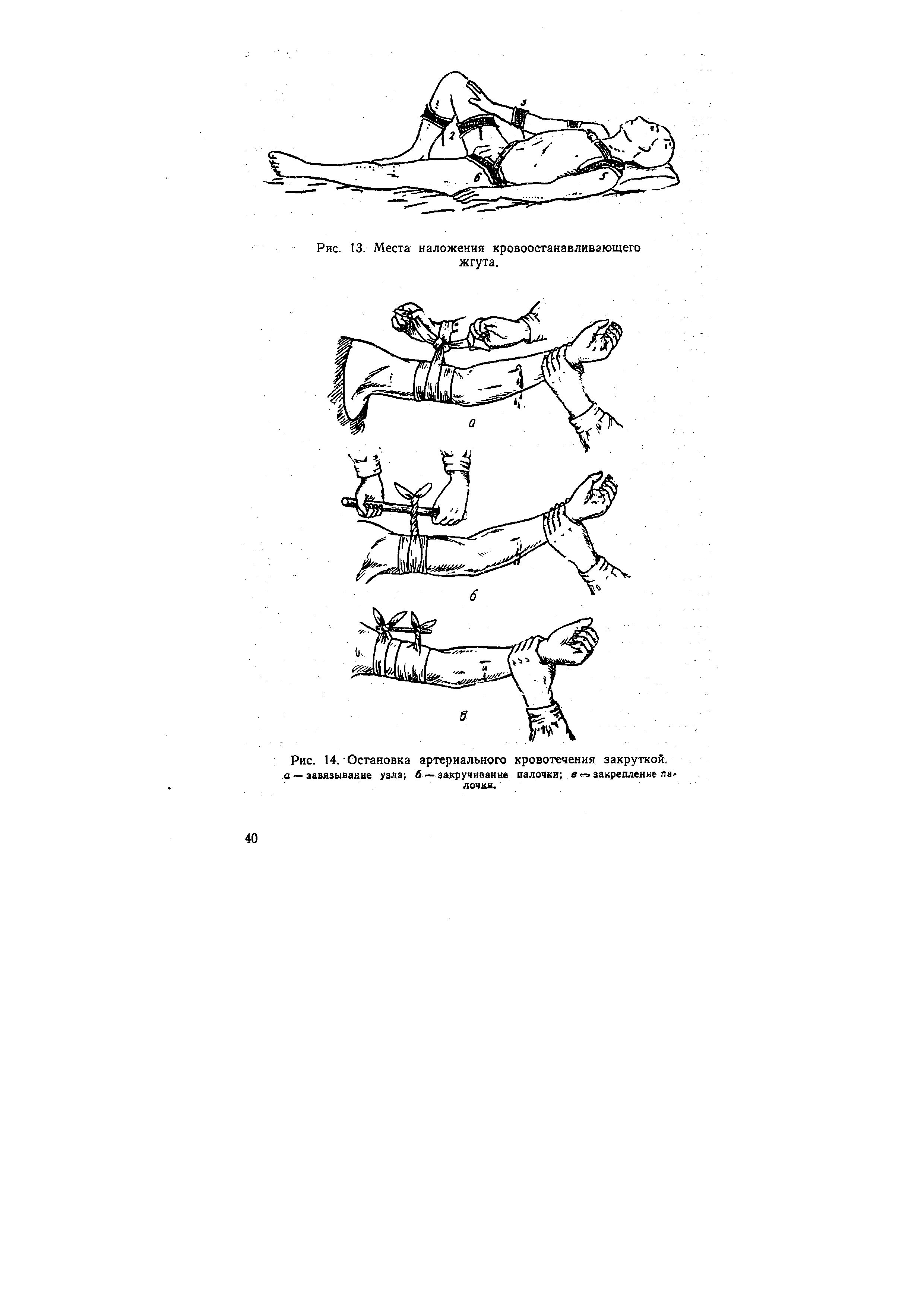 Рис. 14. Остановка артериального кровотечения закруткой, а — завязывание узла 6—закручивание палочки в закрепление па лочки.