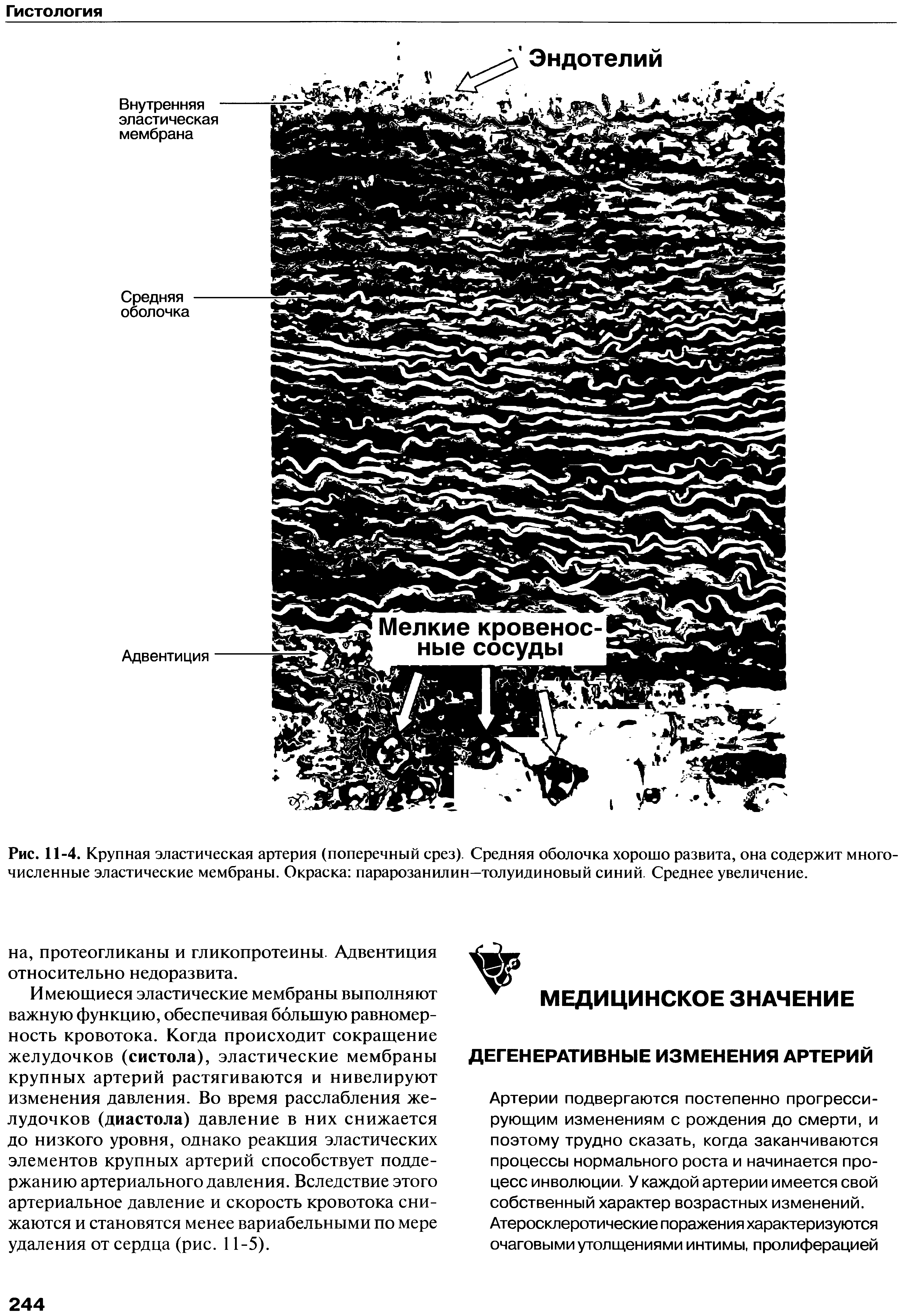 Рис. 11-4. Крупная эластическая артерия (поперечный срез). Средняя оболочка хорошо развита, она содержит многочисленные эластические мембраны. Окраска парарозанилин—толуидиновый синий. Среднее увеличение.