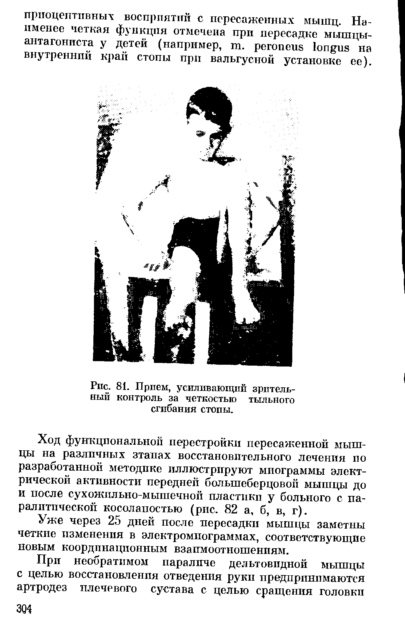 Рис. 81. Прием, усиливающий зрительный контроль за четкостью тыльного сгибания стопы.