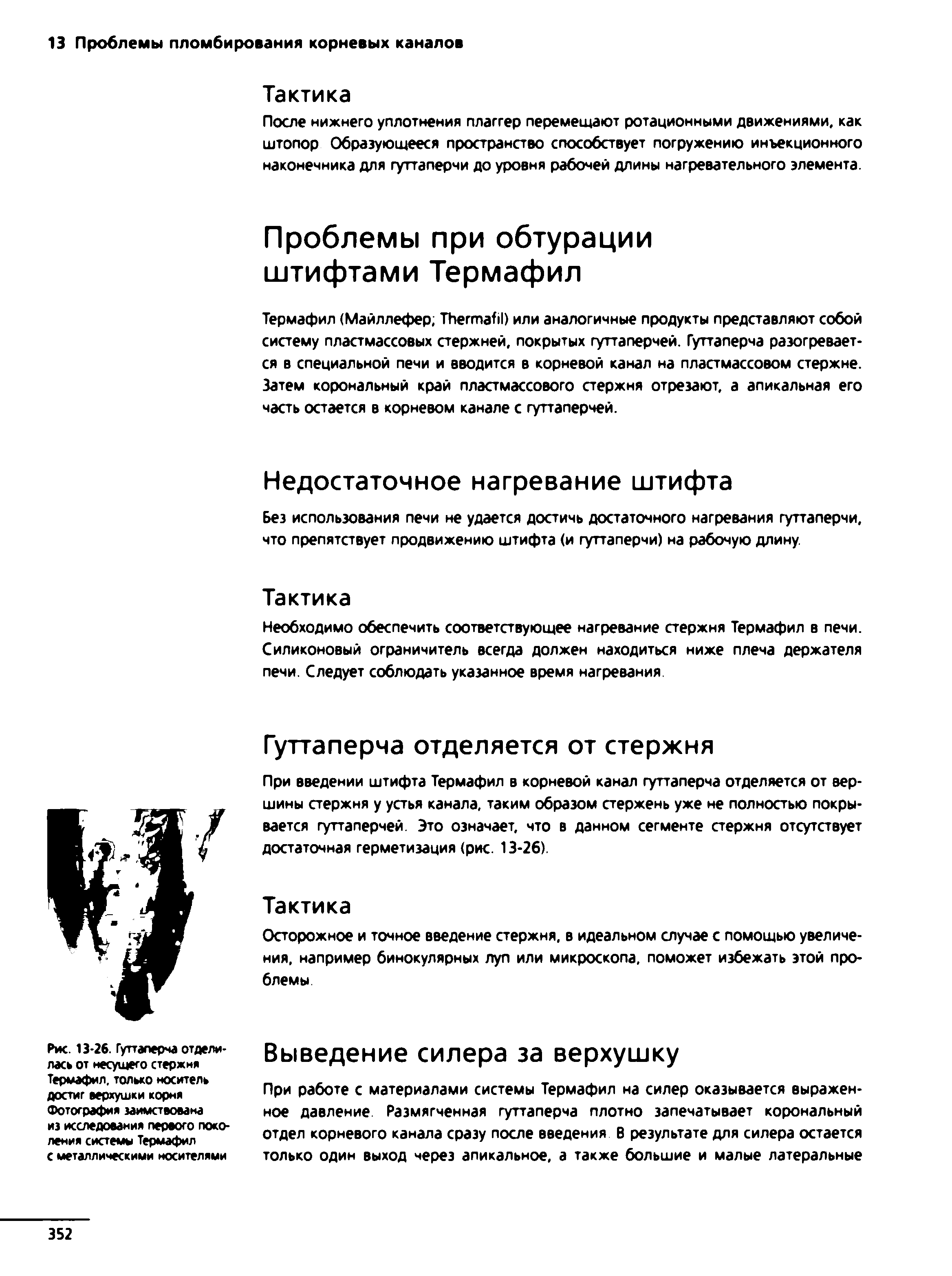 Рис. 13-26. Гуттаперча отделилась от несущего стержня Термафил. только носитель достиг верхушки корня Фотография заимствована из исследования первого поколения системы Термафил с металлическими носителями...