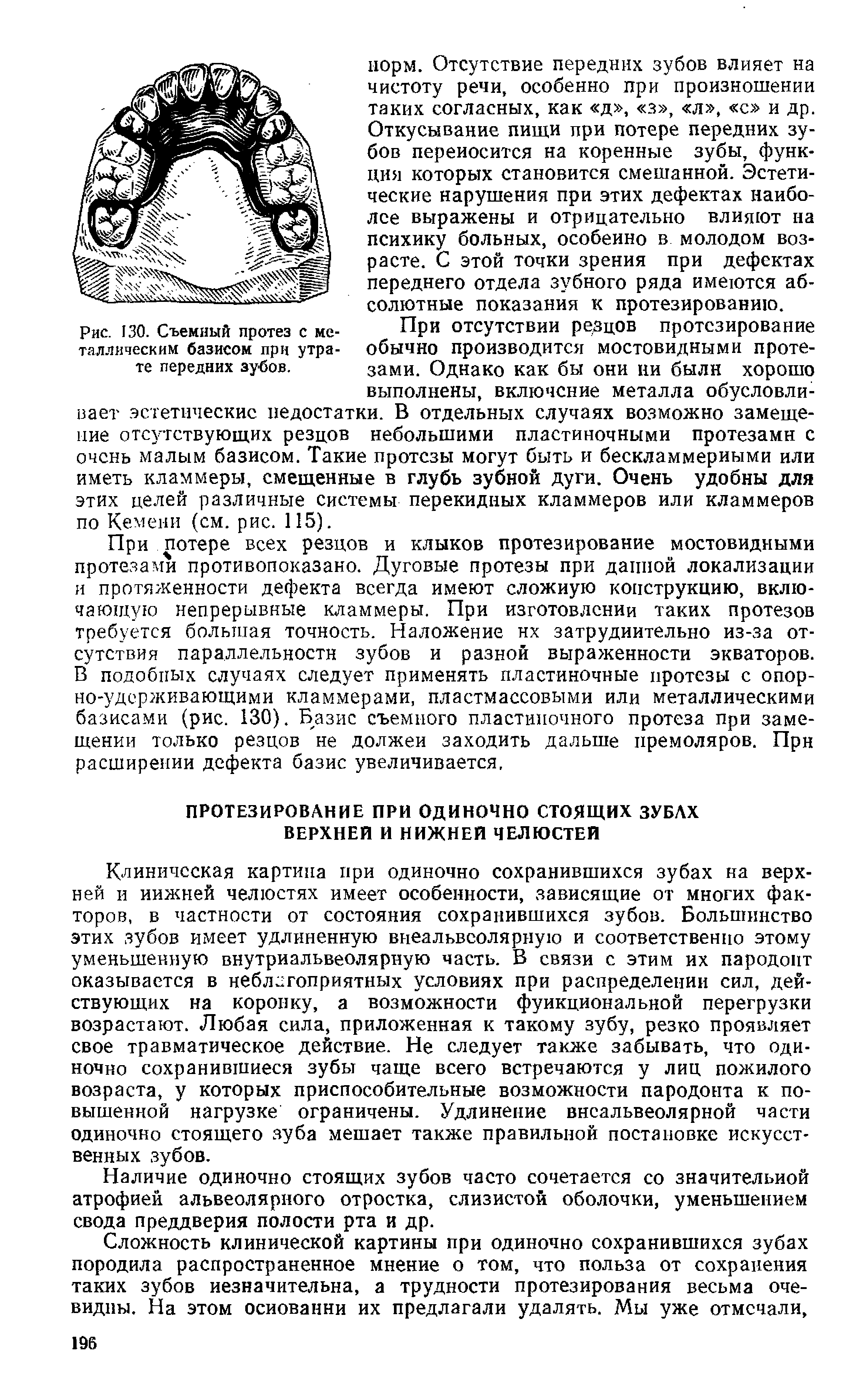 Рис. 130. Съемный протез с металлическим базисом при утрате передних зубов.