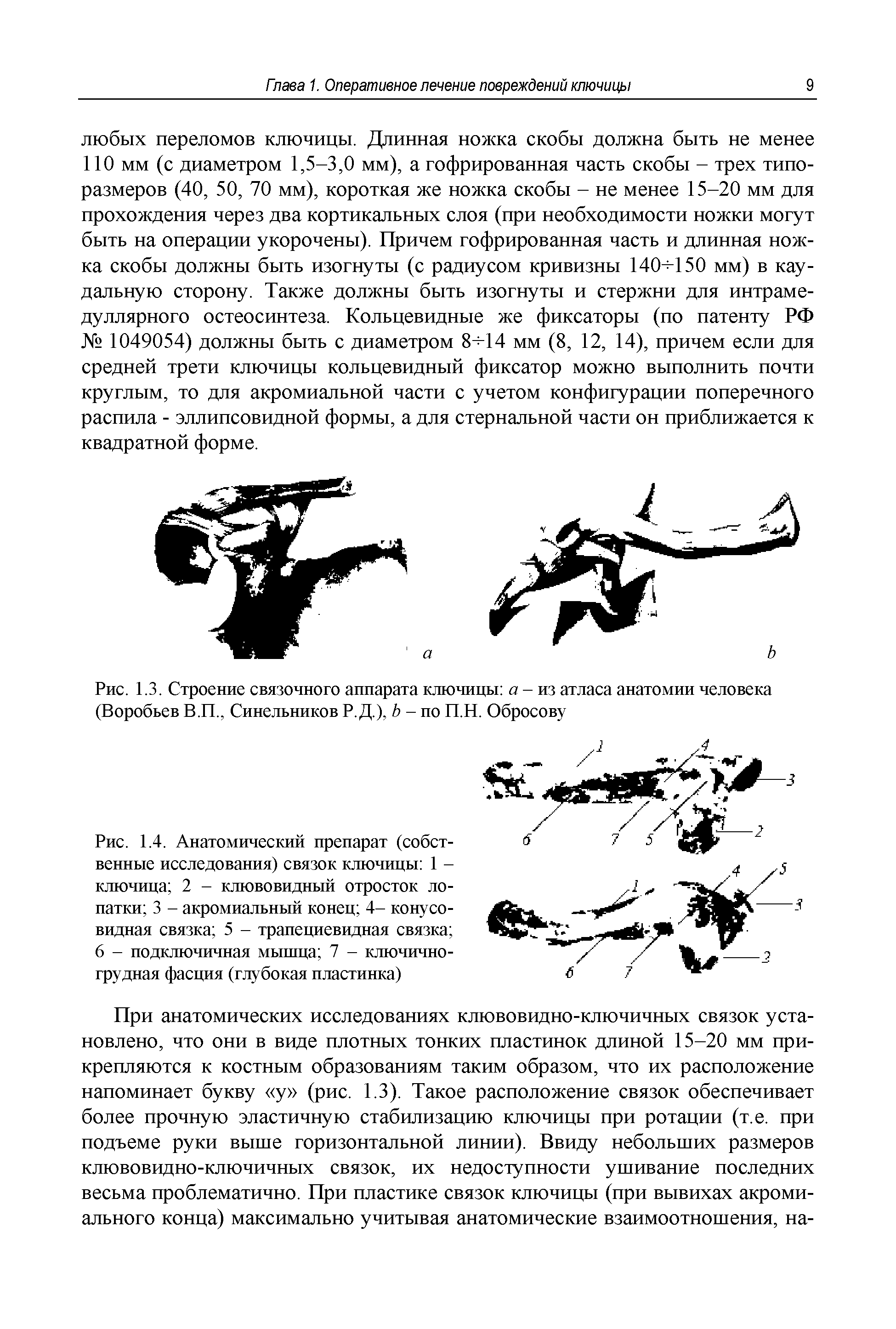 Рис. 1.4. Анатомический препарат (собственные исследования) связок ключицы 1 -ключица 2 - клювовидный отросток лопатки 3 - акромиальный конец 4- конусовидная связка 5 - трапециевидная связка 6 - подключичная мышца 7 - ключичногрудная фасция (глубокая пластинка)...