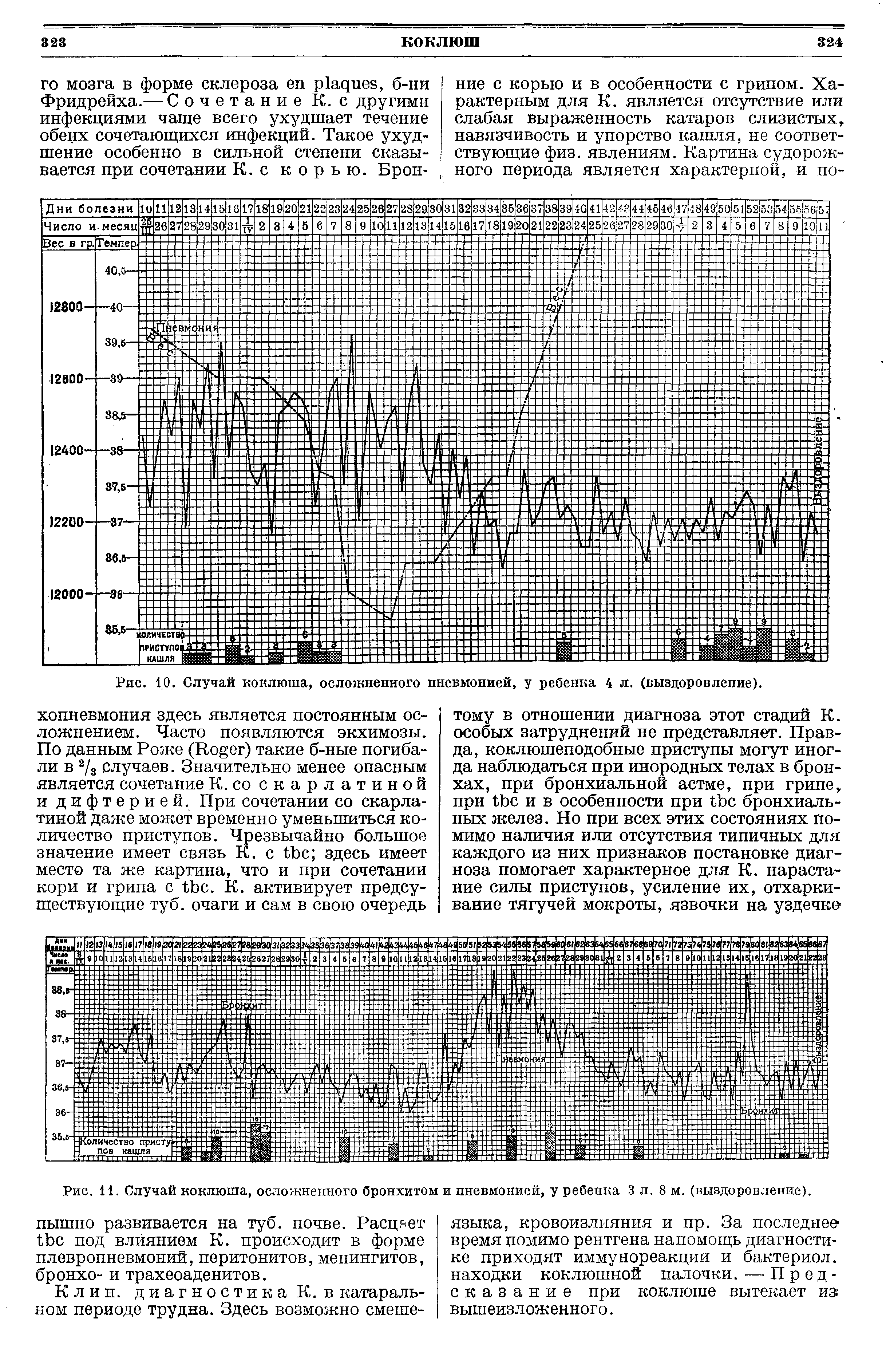 Рис. 1,0. Случай коклюша, осложненного пневмонией, у ребенка 4 л. (выздоровление).