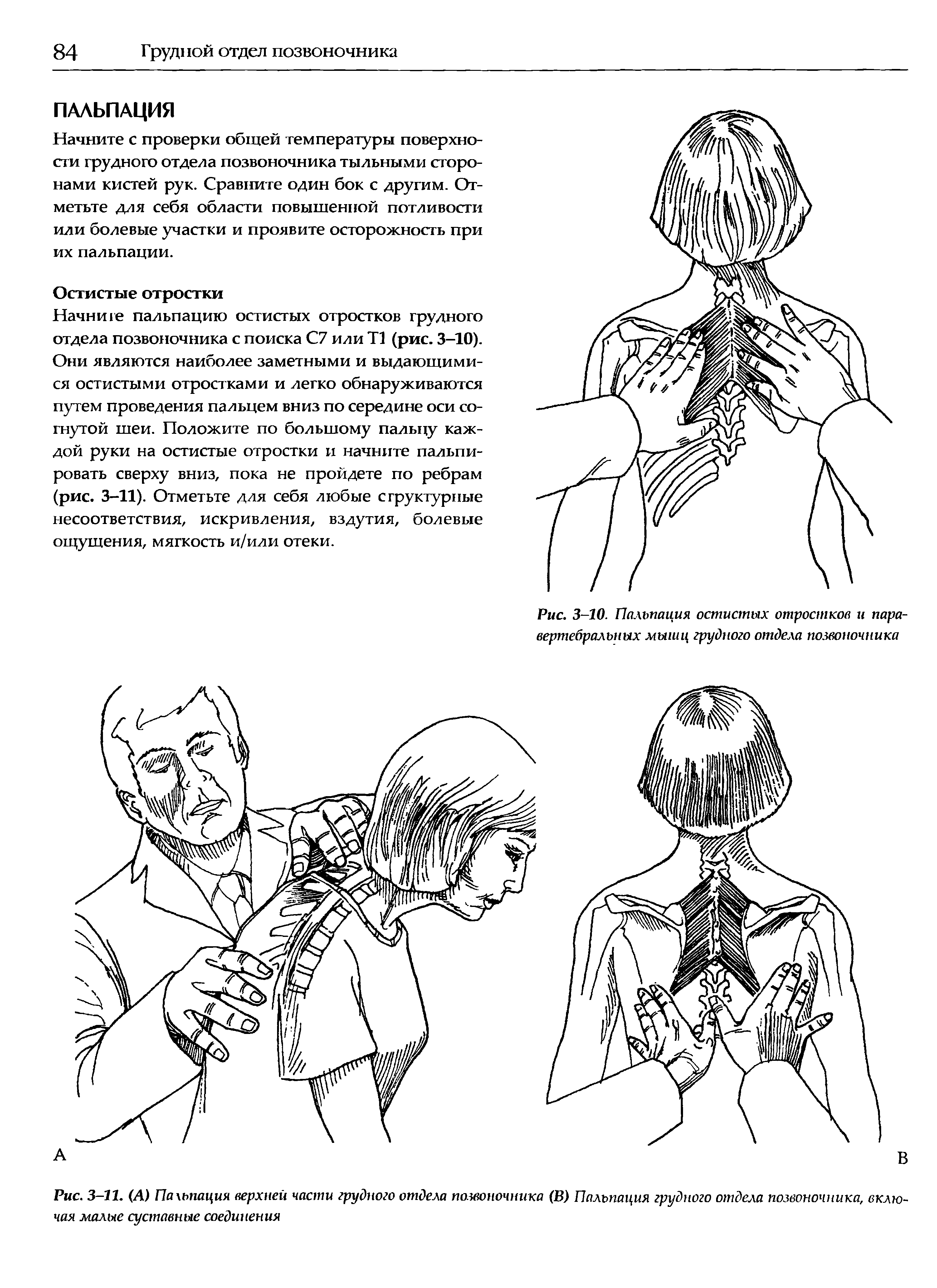 Рис. 3-11. (А) Пахьпация верхней части грудного отдела позвоночника (В) Пальпация грудного отдела позвоночника, включая малые суставные соединения...