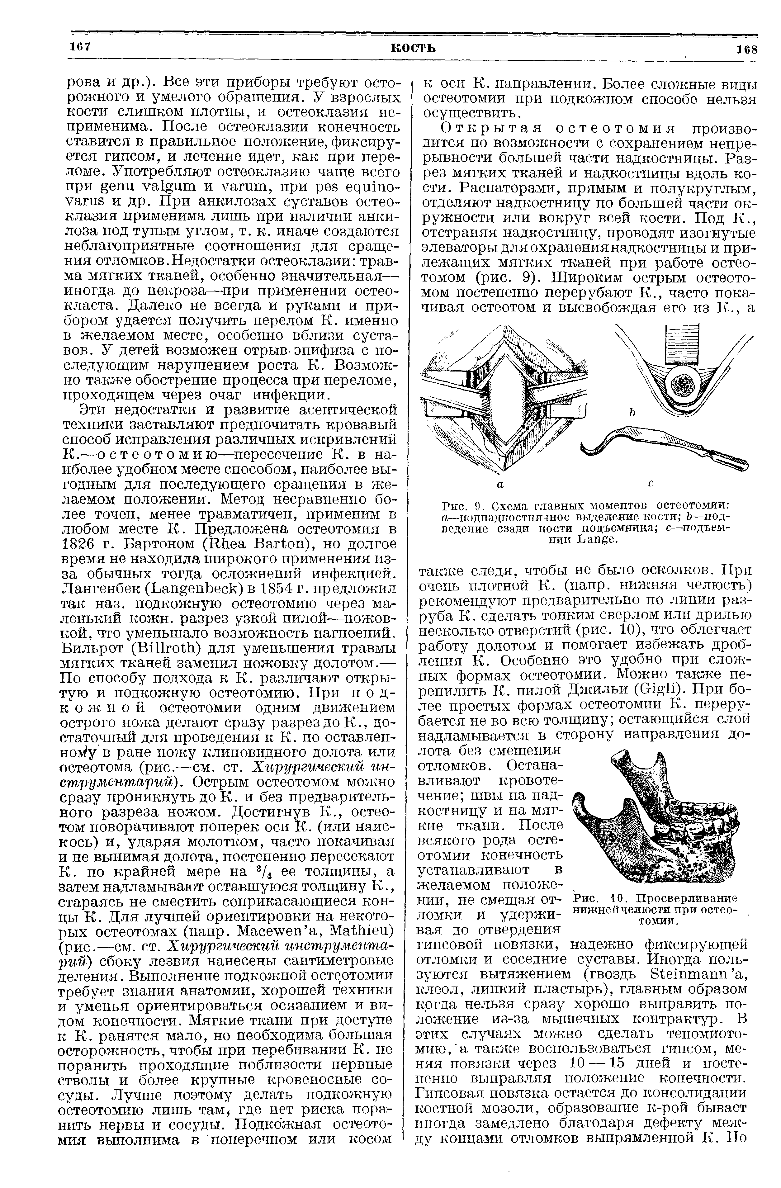 Рис. 9. Схема главных моментов остеотомии а—поднадкостничное выделение кости —подведение сзади кости подъемника с—подъемник L .