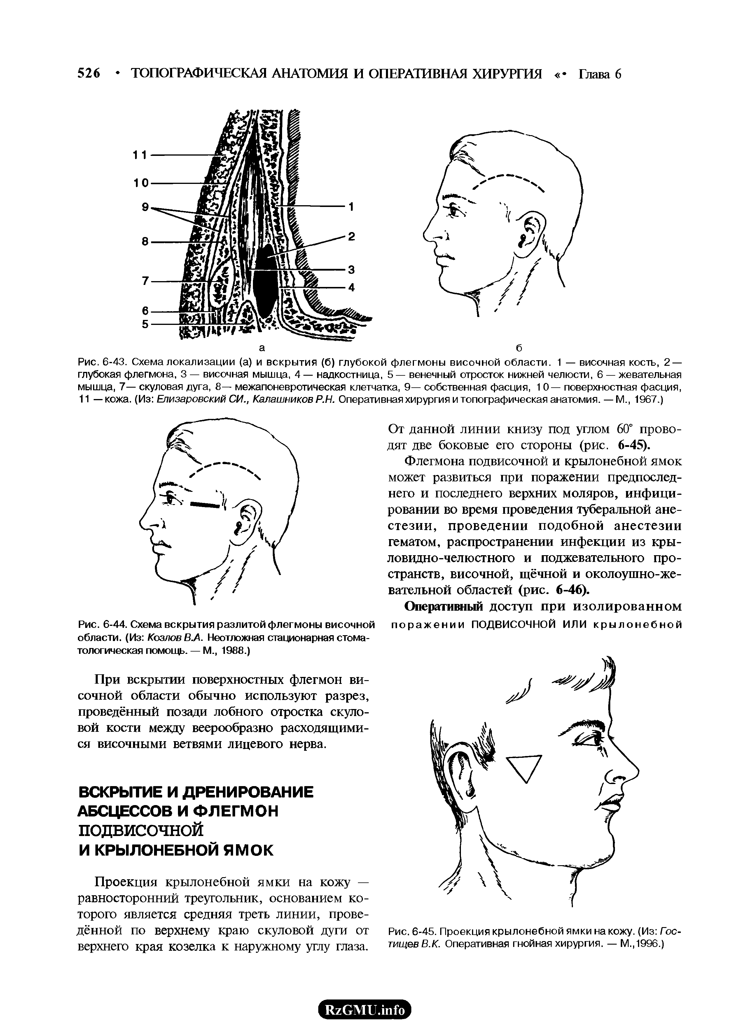 Рис. 6-43. Схема локализации (а) и вскрытия (б) глубокой флегмоны височной области. 1 — височная кость, 2 — глубокая флегмона, 3 — височная мышца, 4 — надкостница, 5 — венечный отросток нижней челюсти, 6 — жевательная мышца, 7— скуловая дуга, 8— межапоневротическая клетчатка, 9— собственная фасция, 1 0— поверхностная фасция, 11 — кожа. (Из Елизаровский СИ., Калашников Р.Н. Оперативная хирургия и топографическая анатомия. — М., 1967.)...