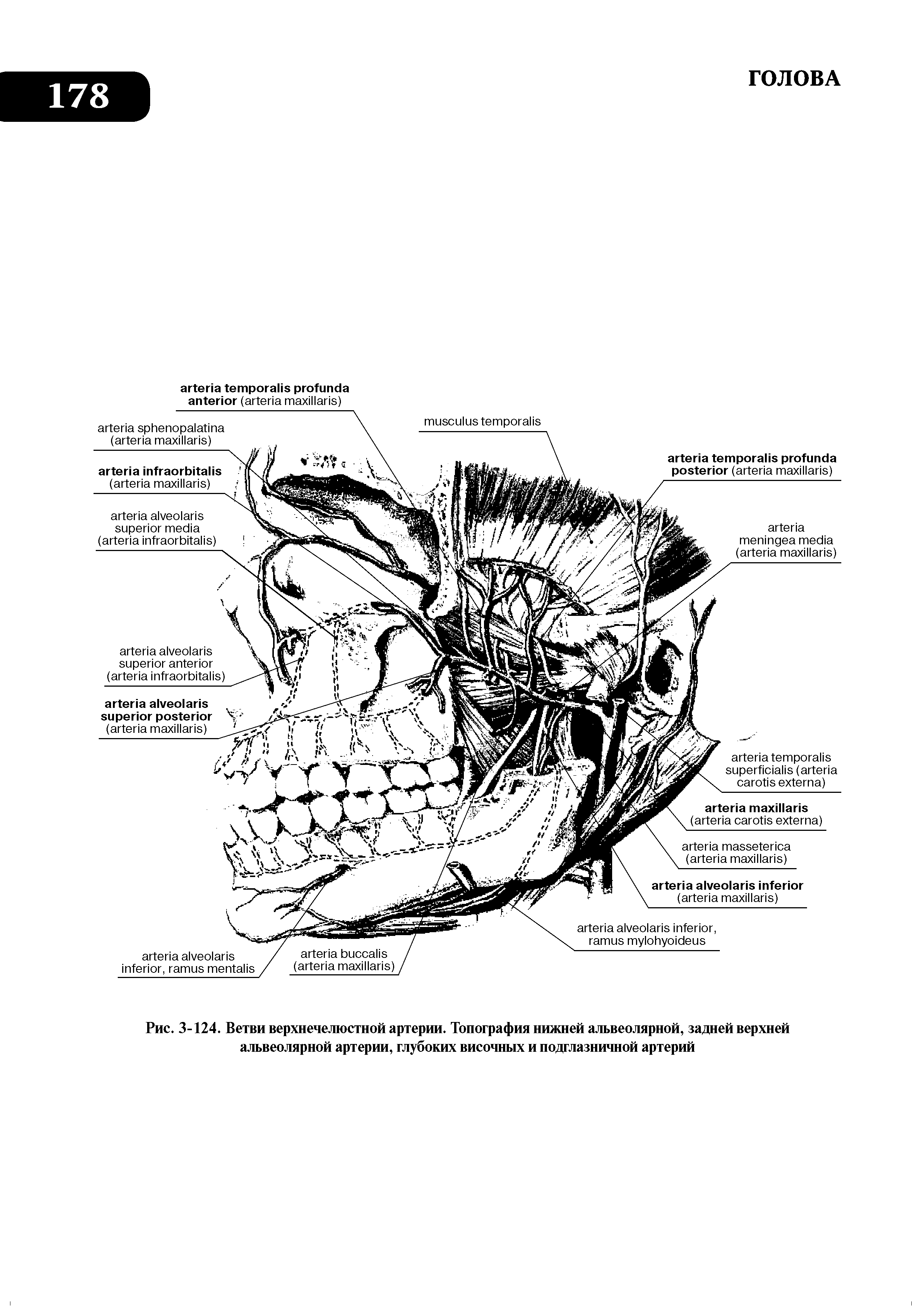 Рис. 3-124. Ветви верхнечелюстной артерии. Топография нижней альвеолярной, задней верхней альвеолярной артерии, глубоких височных и подглазничной артерий...