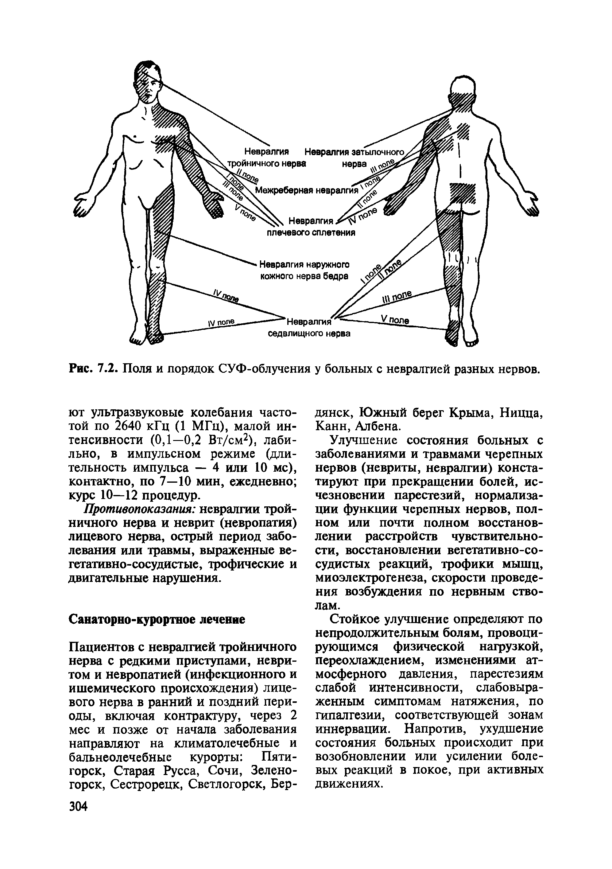 Рис. 7.2. Поля и порядок СУФ-облучения у больных с невралгией разных нервов.