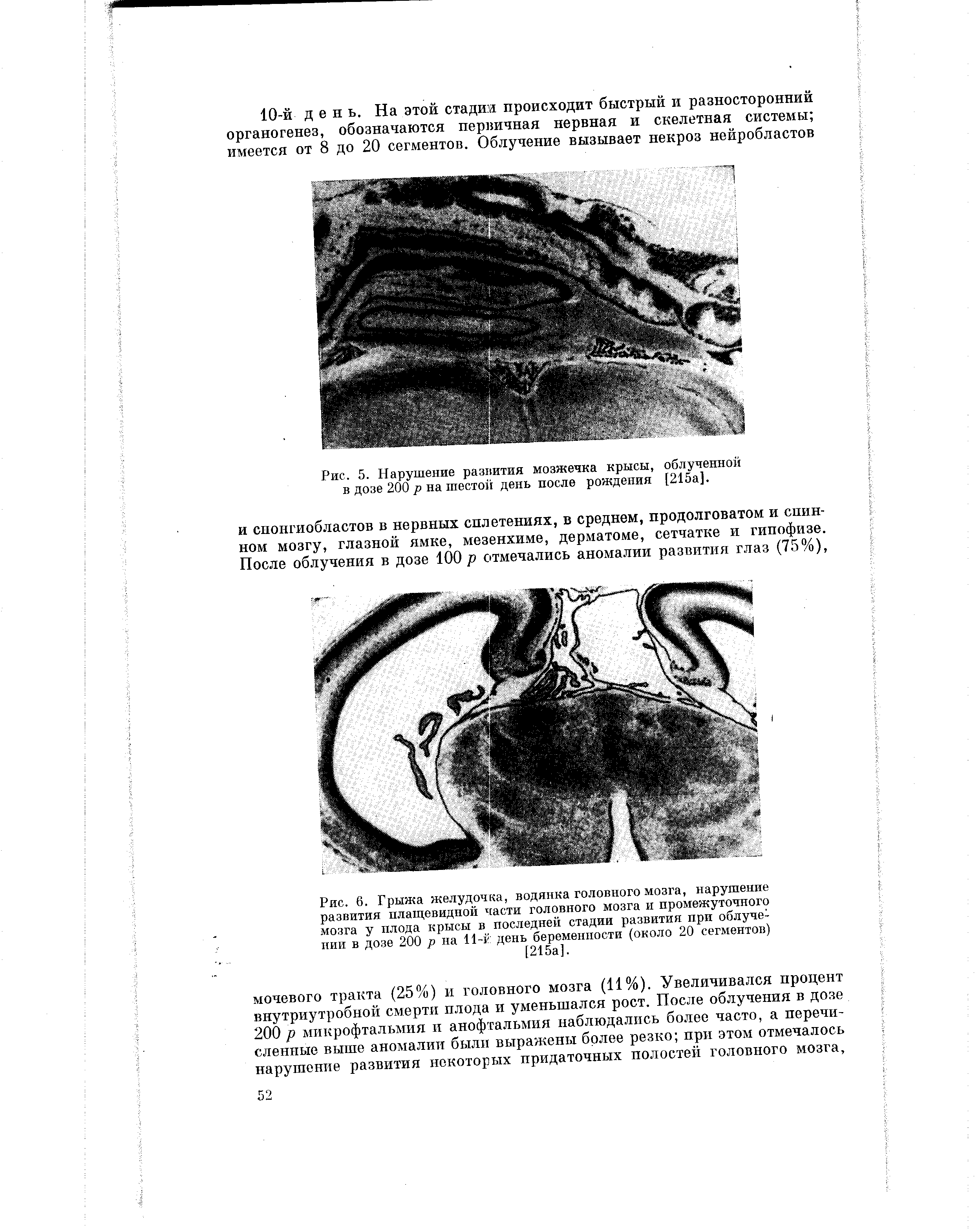 Рис. 6. Грыжа желудочка, водянка головного мозга, нарушение развития плащевидной части головного мозга и промежуточного мозга у плода крысы в последней стадии развития при облучении в дозе 200 р на 11-г день беременности (около 20 сегментов) [215а].