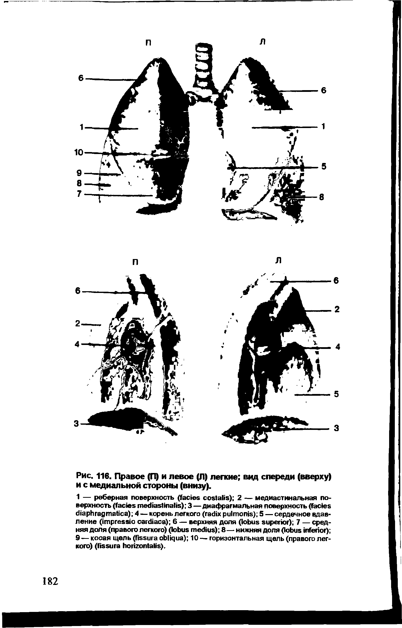 Рис. 116. Правое (П) и левое (Л) легкие вид спереди (вверху) и с медиальной стороны (внизу).