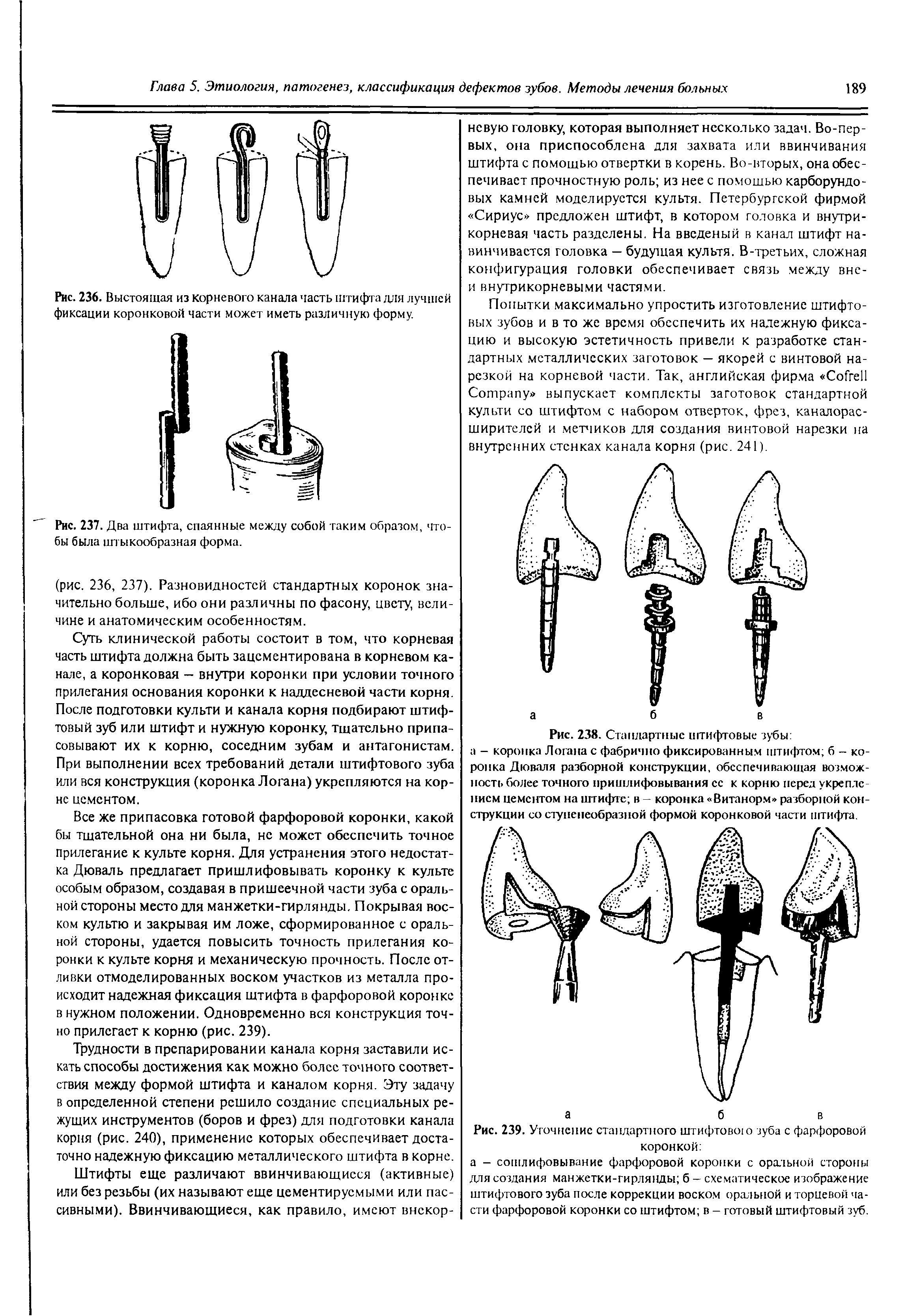 Рис. 239. Уточнение стандартного штифтовою зуба с фарфоровой коронкой ...