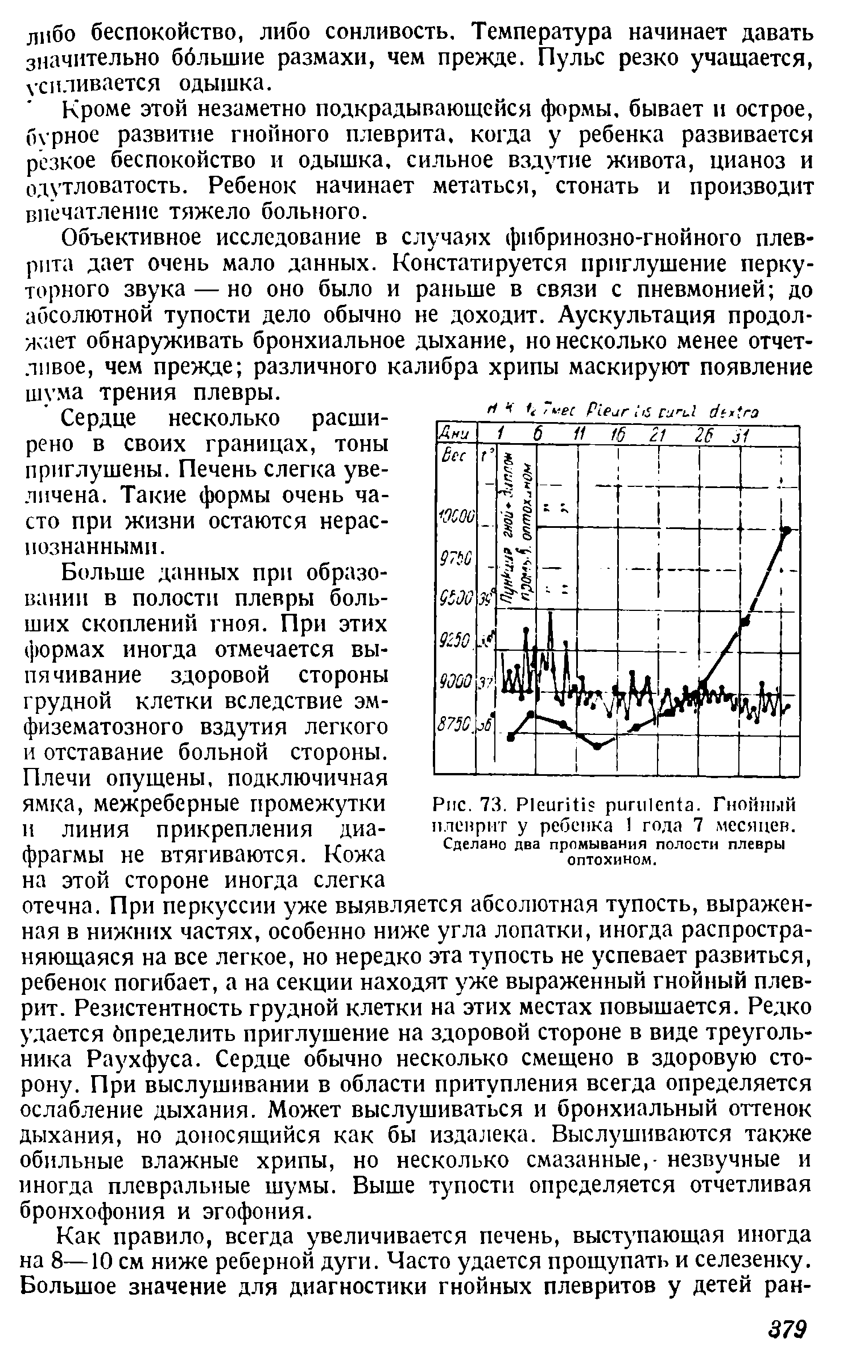 Рис. 73. P . Гнойный плеврит у ребенка 1 года 7 месяцев. Сделано два промывания полости плевры оптохином.