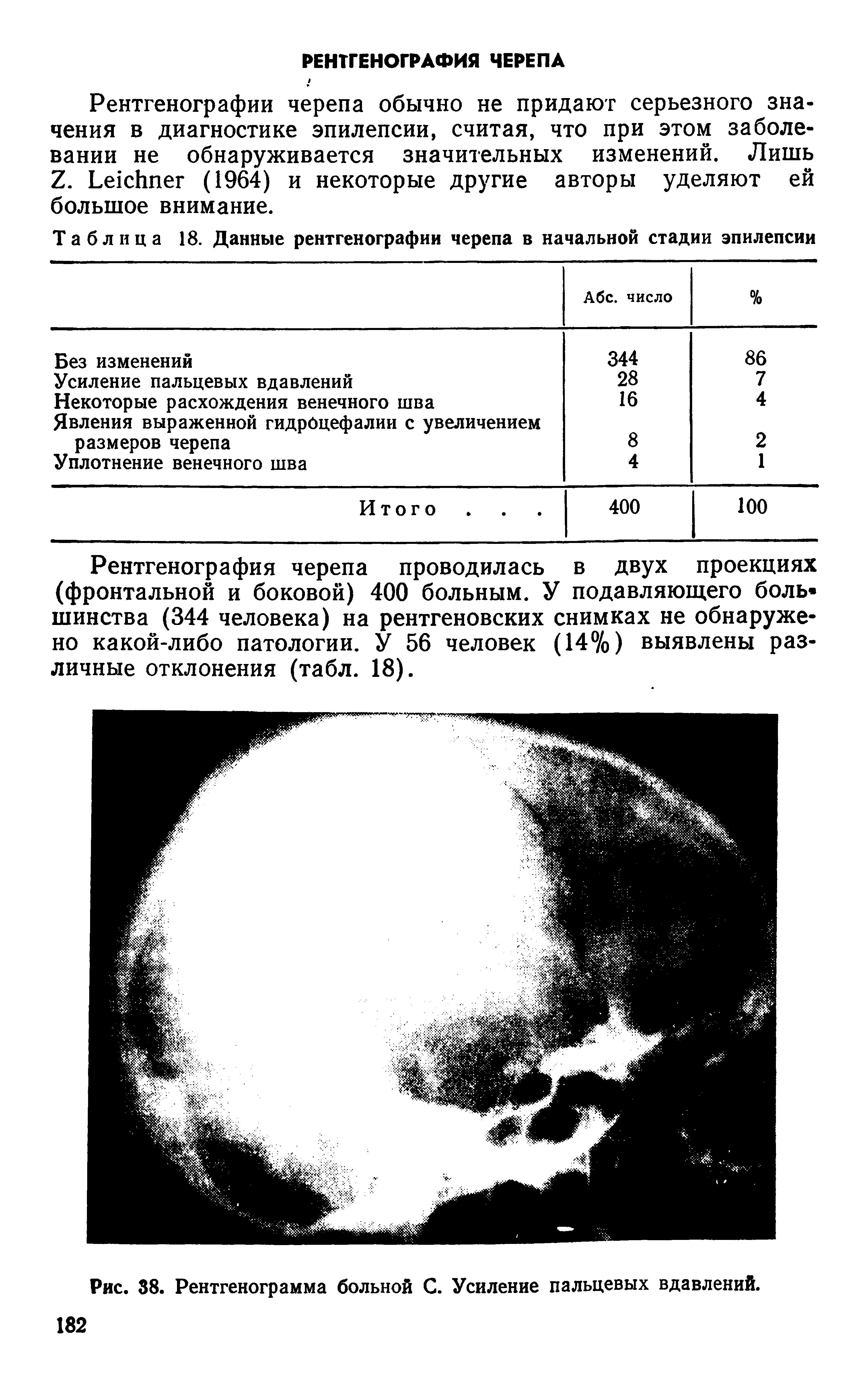 Таблица 18. Данные рентгенографии черепа в начальной стадии эпилепсии...