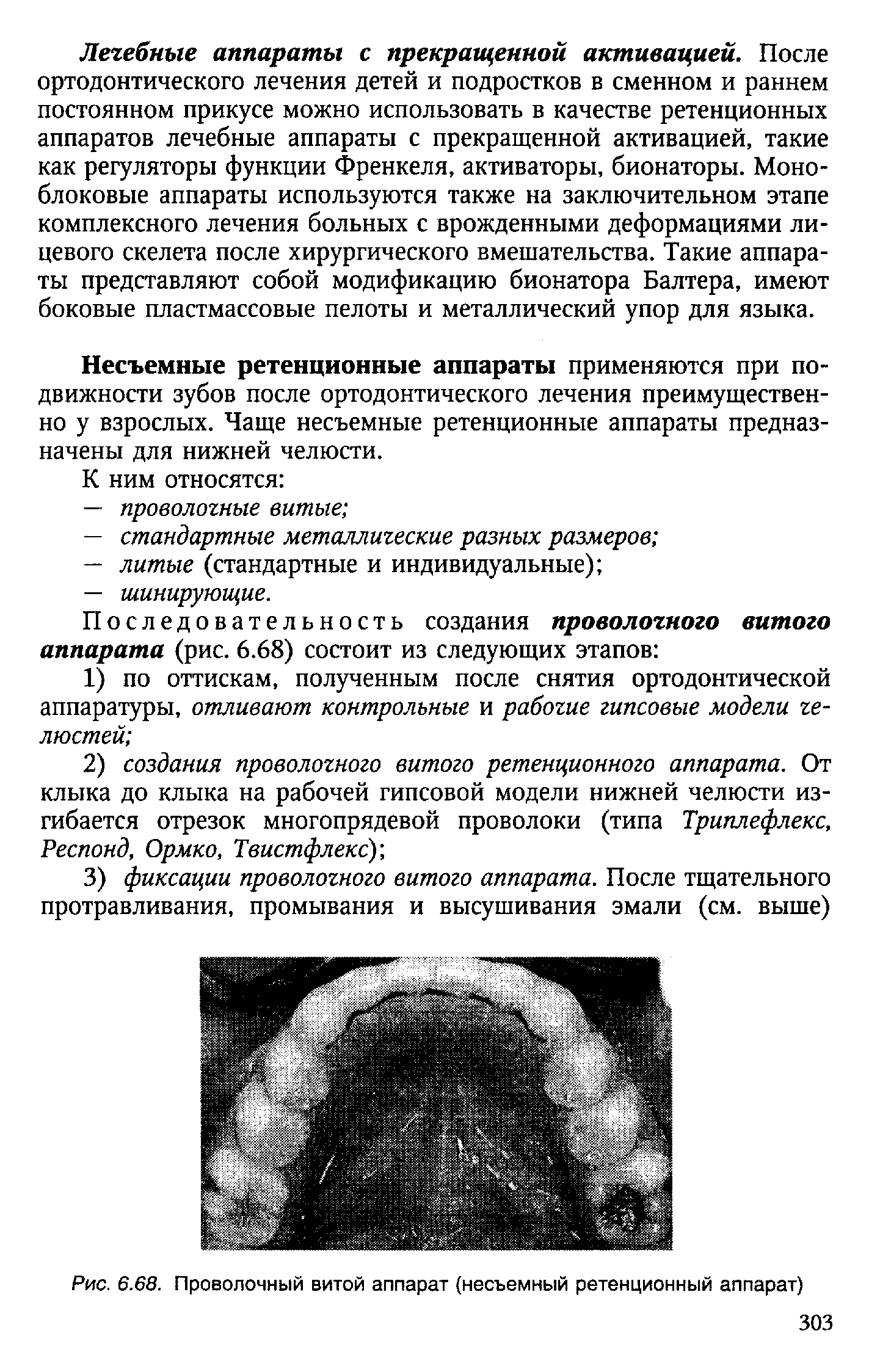 Рис. 6.68. Проволочный витой аппарат (несъемный ретенционный аппарат)...