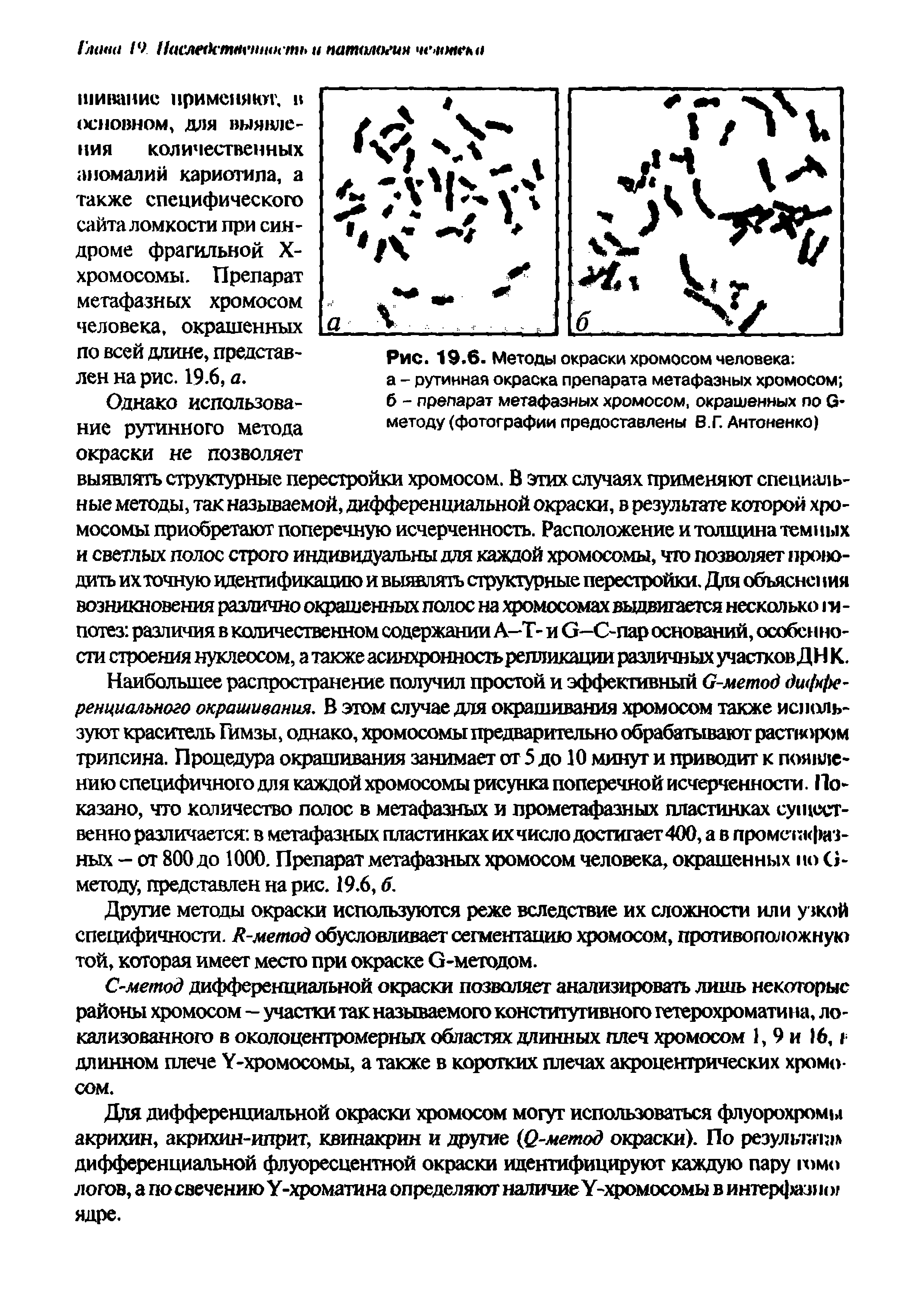 Рис. 19.6. Методы окраски хромосом человека а - рутинная окраска препарата метафазных хромосом б - препарат метафазных хромосом, окрашенных по О-методу (фотографии предоставлены В.Г. Антоненко)...