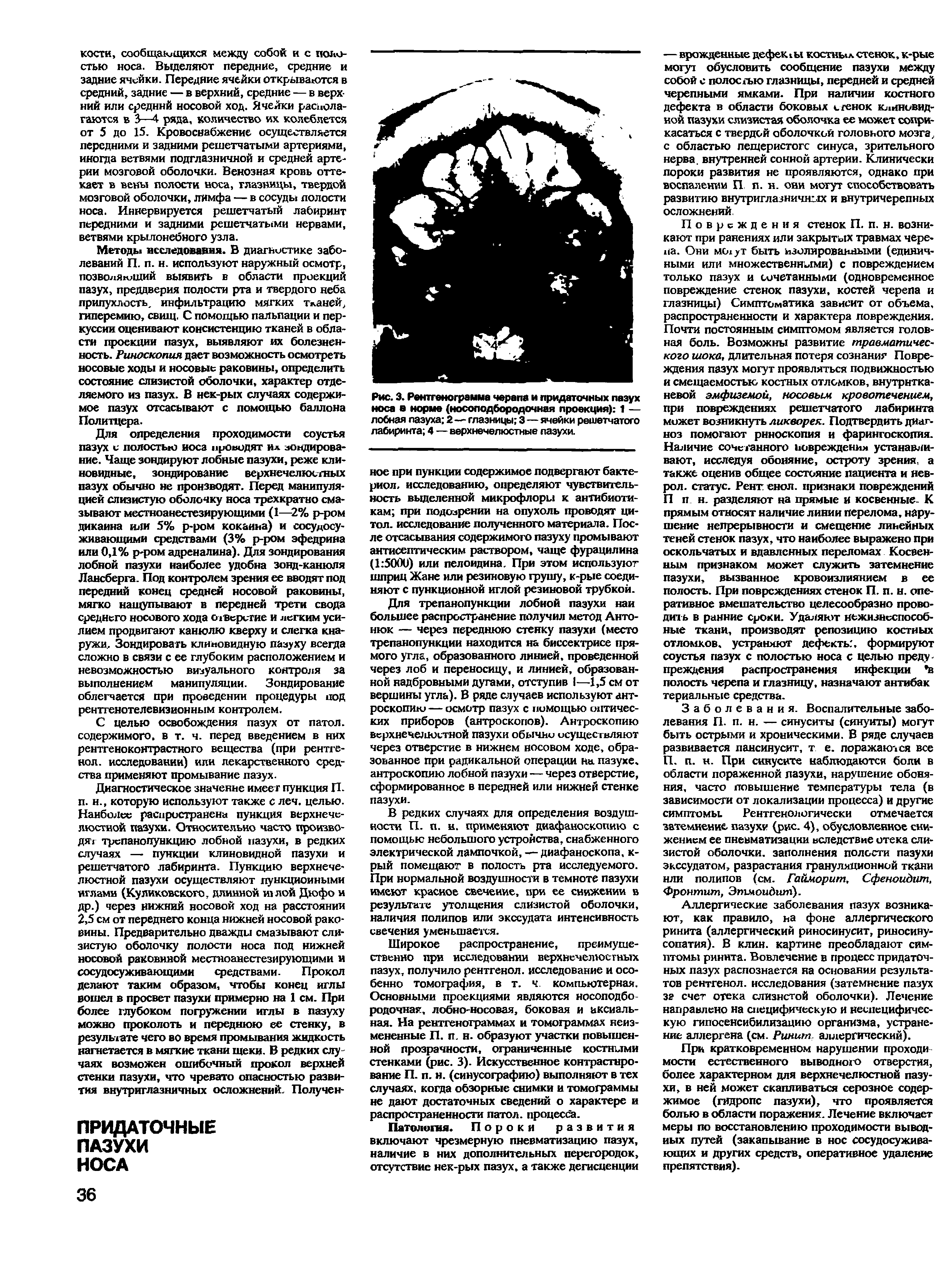 Рис. 3. Рентгенограмма черепа и придаточных пазух носа в норме (носоподбородочная проекция) 1 — лобная пазуха 2— глазницы 3—ячейки решетчатого лабиринта 4 — верхнечелюстные пазухи.