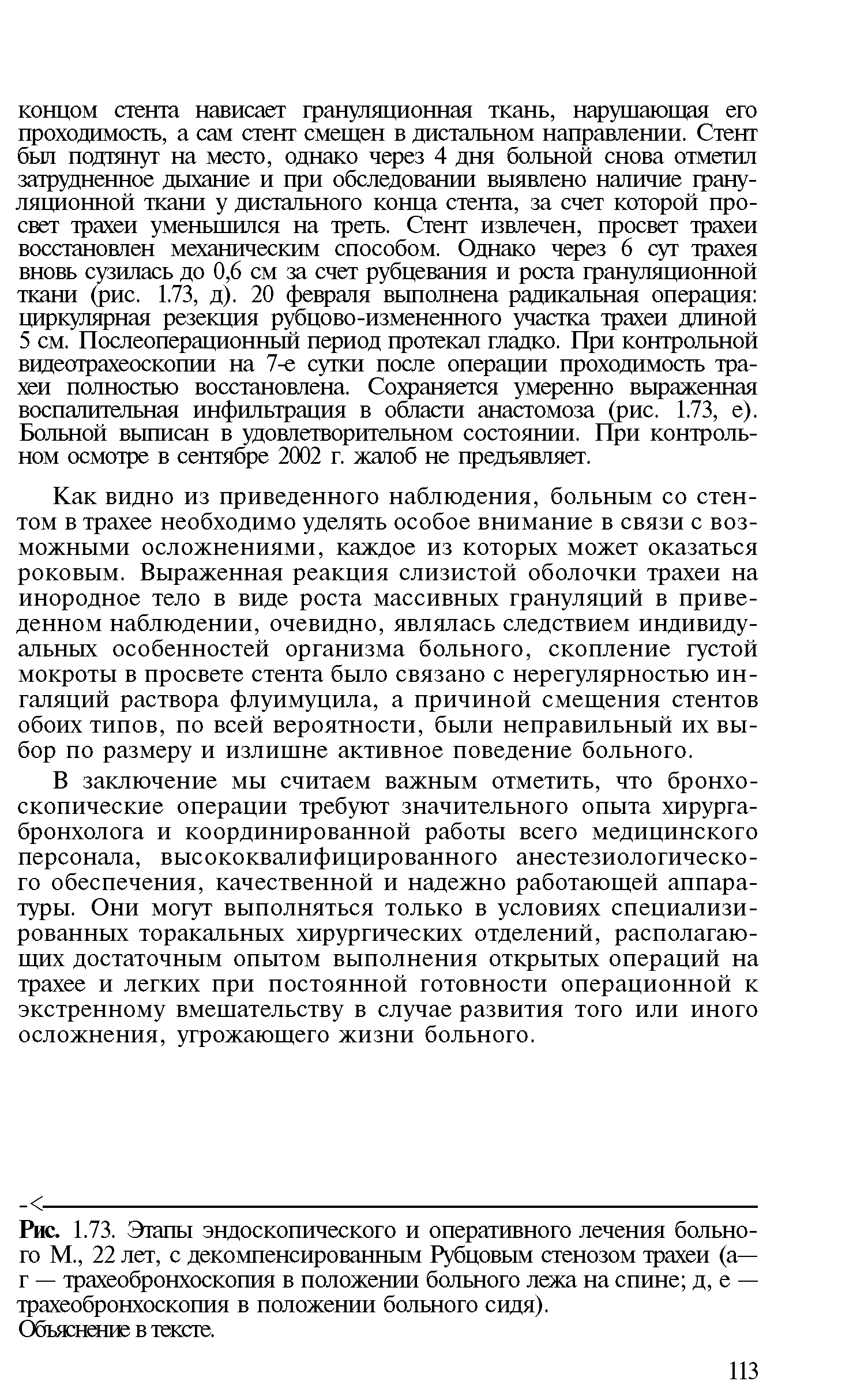 Рис. 1.73. Этапы эндоскопического и оперативного лечения больного М., 22 лет, с декомпенсированным Рубцовым стенозом трахеи (а— г — трахеобронхоскопия в положении больного лежа на спине д, е — трахеобронхоскопия в положении больного сидя).