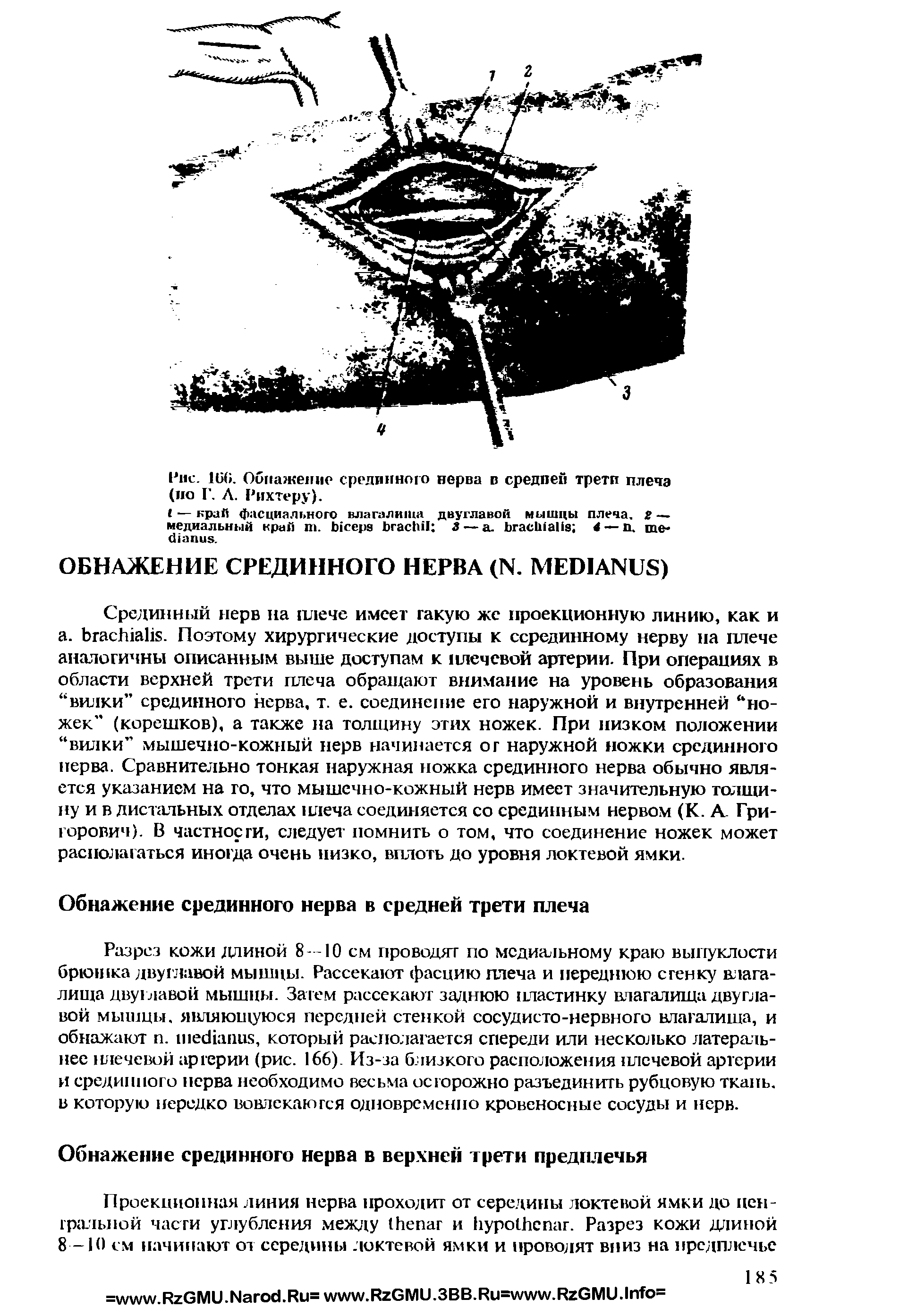 Рис. 16(>. Обнажение срединною нерва в средней трети плеча (по Г. Л. Рихтеру).