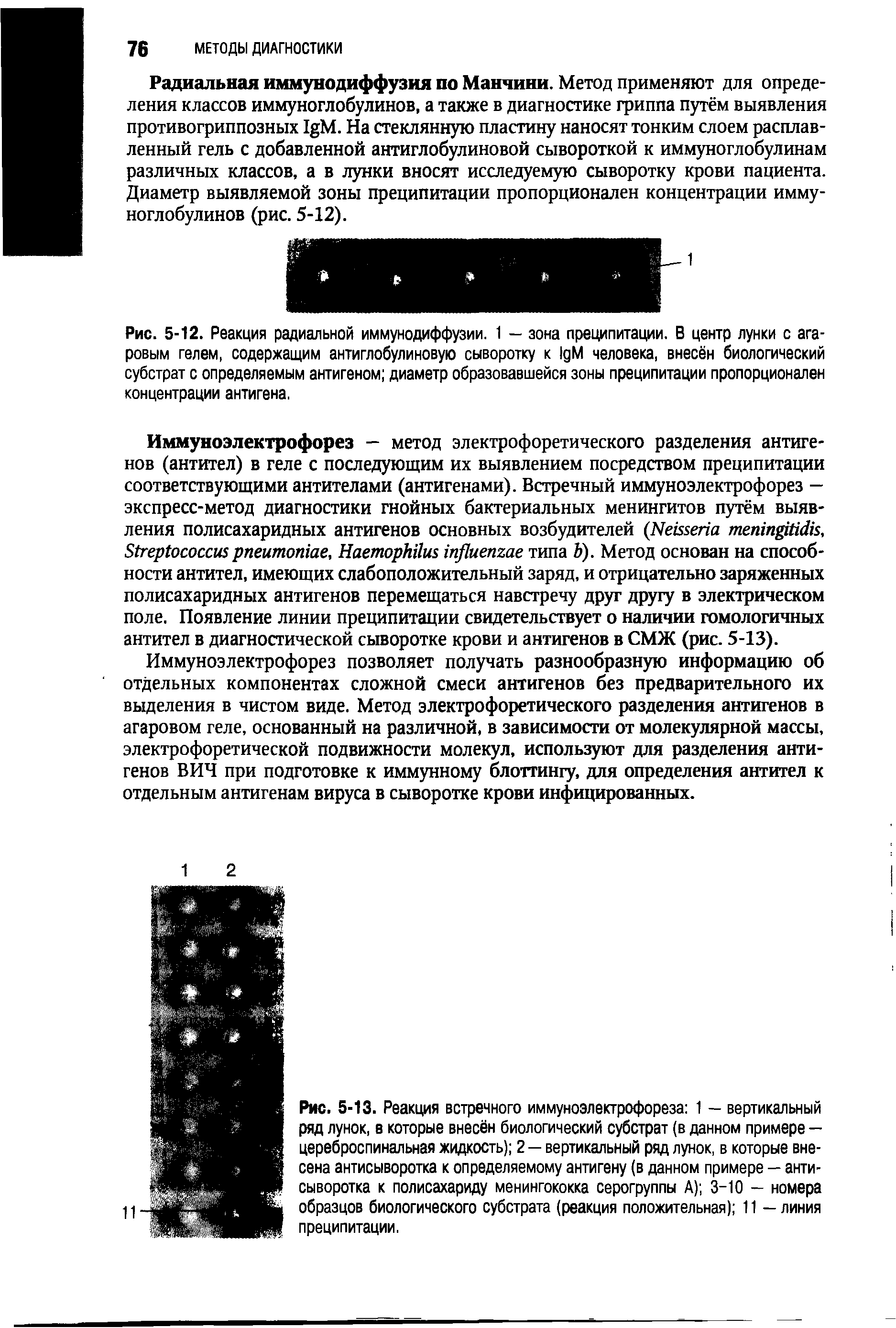 Рис. 5-12. Реакция радиальной иммунодиффузии. 1 — зона преципитации. В центр лунки с агаровым гелем, содержащим антиглобулиновую сыворотку к 1дМ человека, внесён биологический субстрат с определяемым антигеном диаметр образовавшейся зоны преципитации пропорционален концентрации антигена.