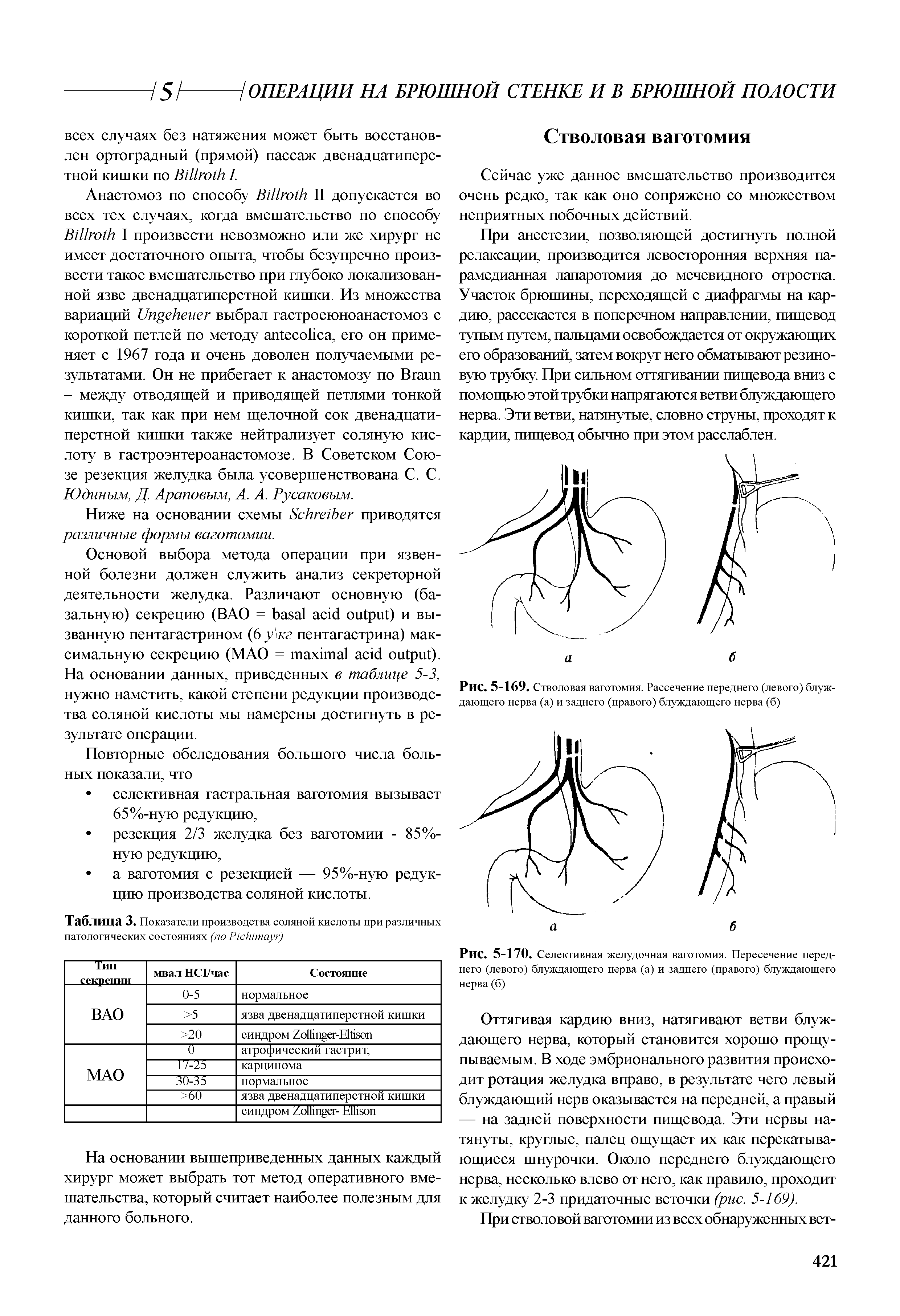 Рис. 5-170. Селективная желудочная ваготомия. Пересечение переднего (левого) блуждающего нерва (а) и заднего (правого) блуждающего нерва(б)...