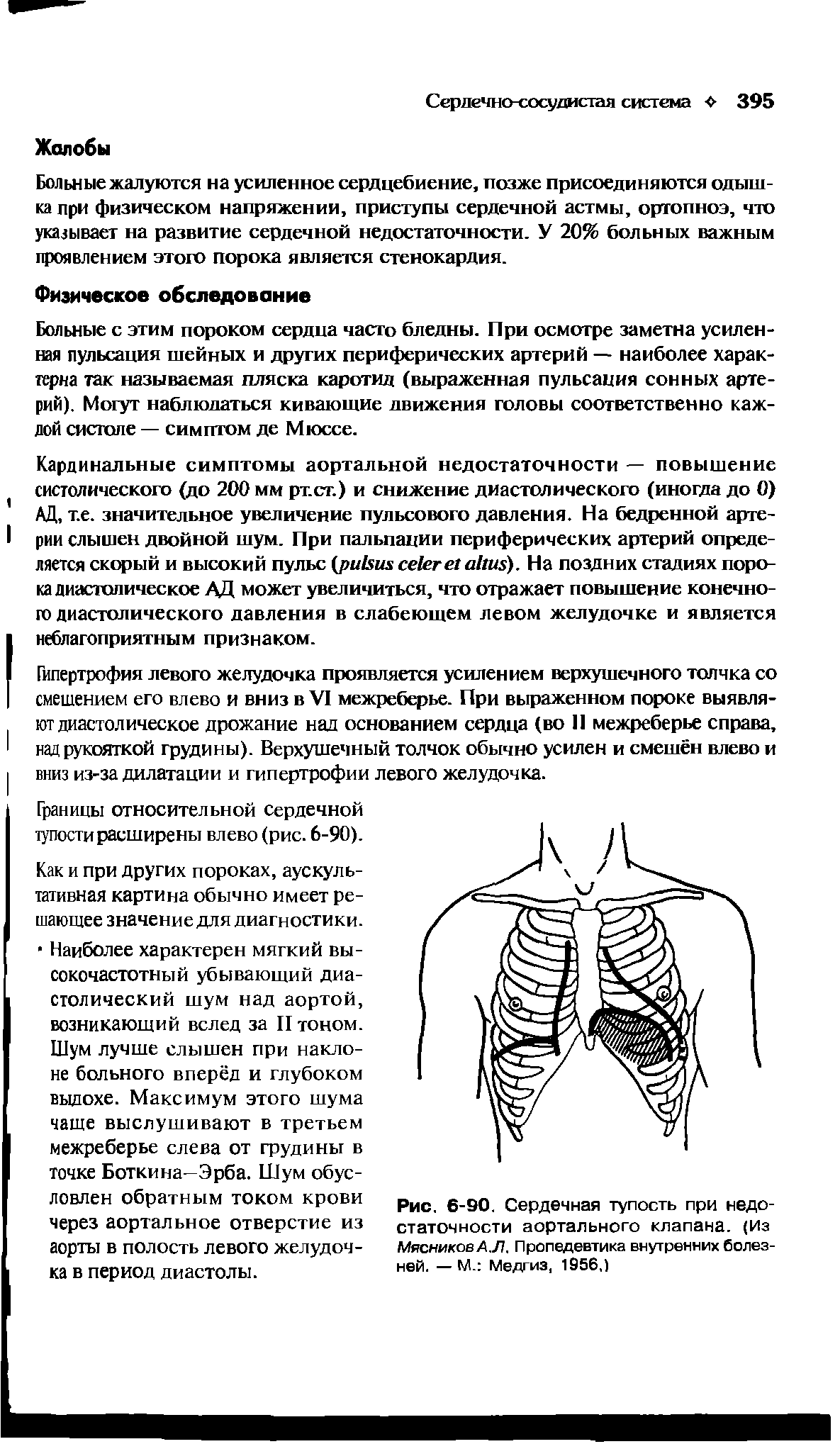 Рис. 6-90. Сердечная тупость при недостаточности аортального клапана. (Из МясниковАЛ. Пропедевтика внутренних болезней. — М. Медгиз, 1956,)...