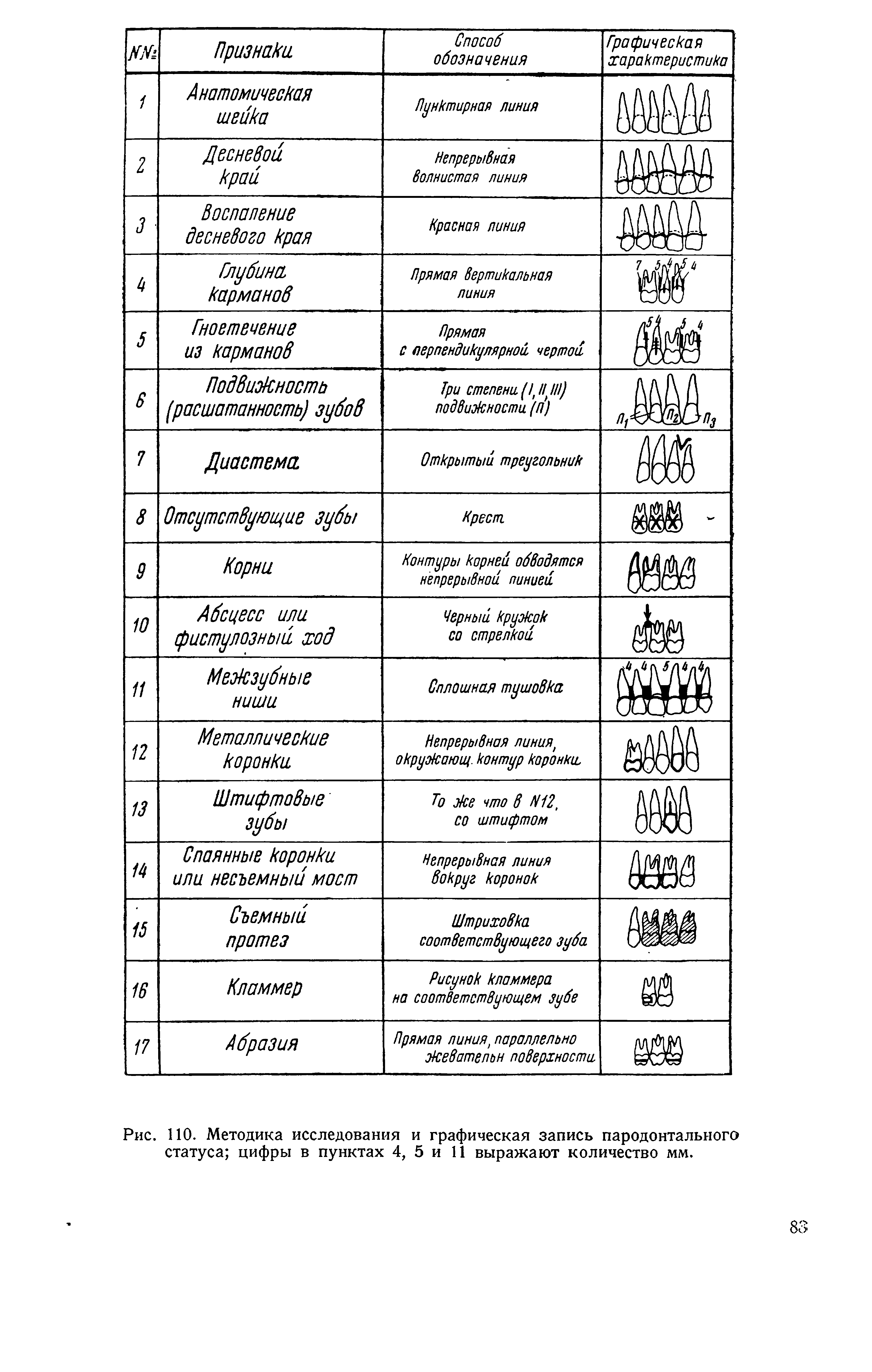 Рис. 110. Методика исследования и графическая запись пародонтального статуса цифры в пунктах 4, 5 и 11 выражают количество мм.