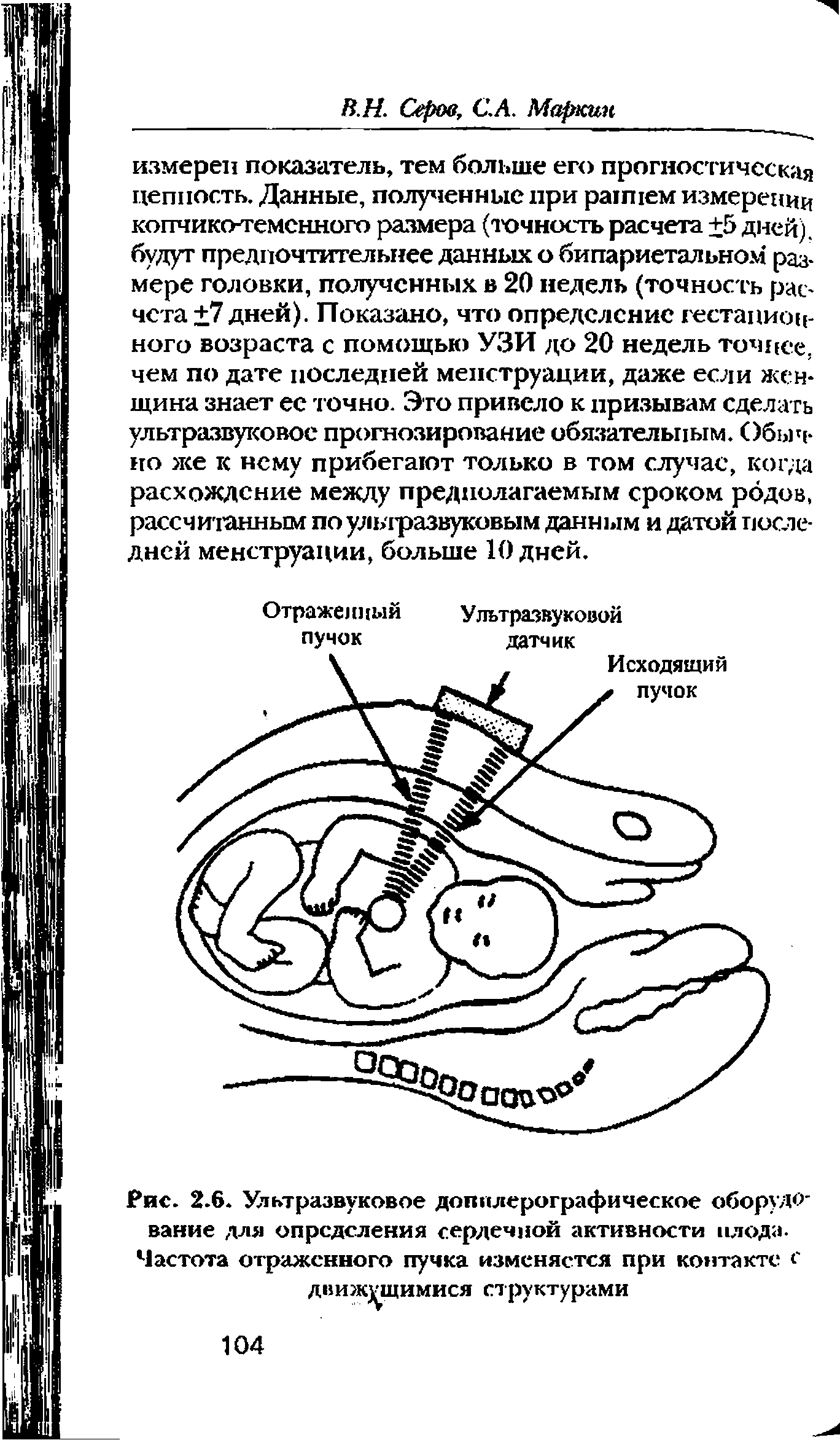 Рис. 2.6. Ультразвуковое допплерографическое оборуДО" ванне для определения сердечной активности плода-Частота отраженного пучка изменяется при контакте с...