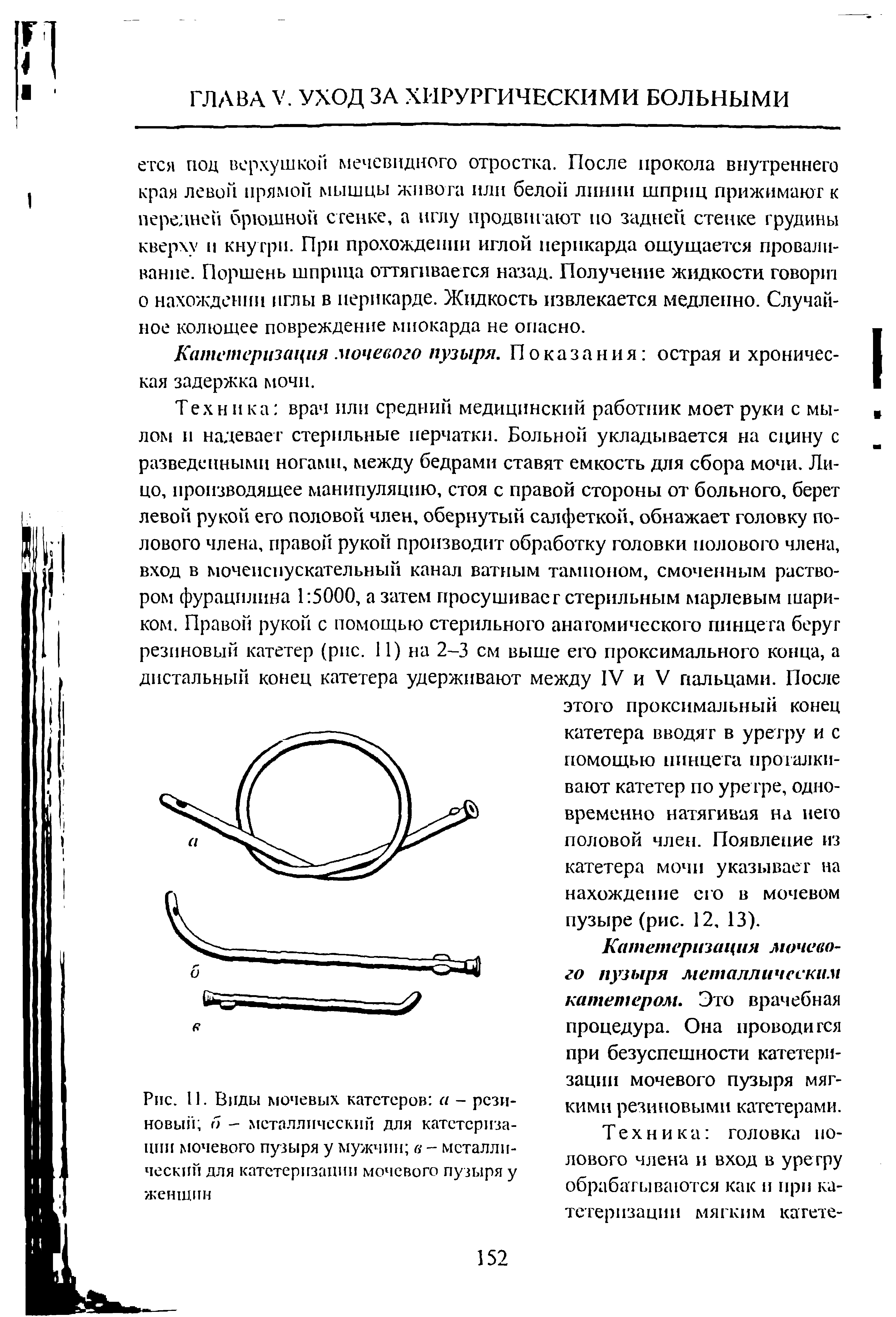 Рис. 11. Виды мочевых катетеров а - резиновый б - металлический для катетеризации мочевого пузыря у мужчин в - металлический для катетеризации мочевого пузыря у женщин...