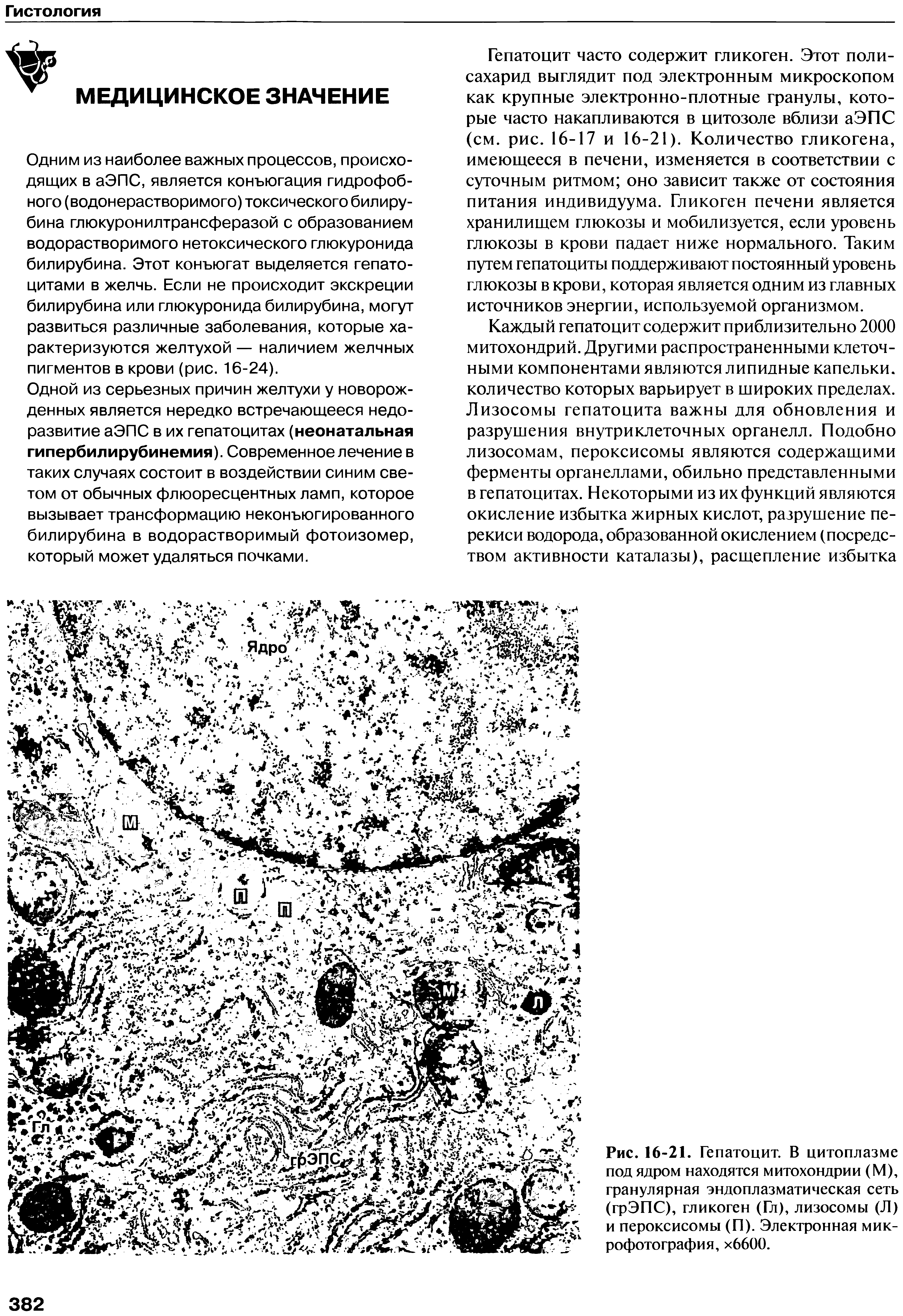 Рис. 16-21. Гепатоцит. В цитоплазме под ядром находятся митохондрии (М), гранулярная эндоплазматическая сеть (грЭПС), гликоген (Гл), лизосомы (Л) и пероксисомы (П). Электронная микрофотография, хббОО.