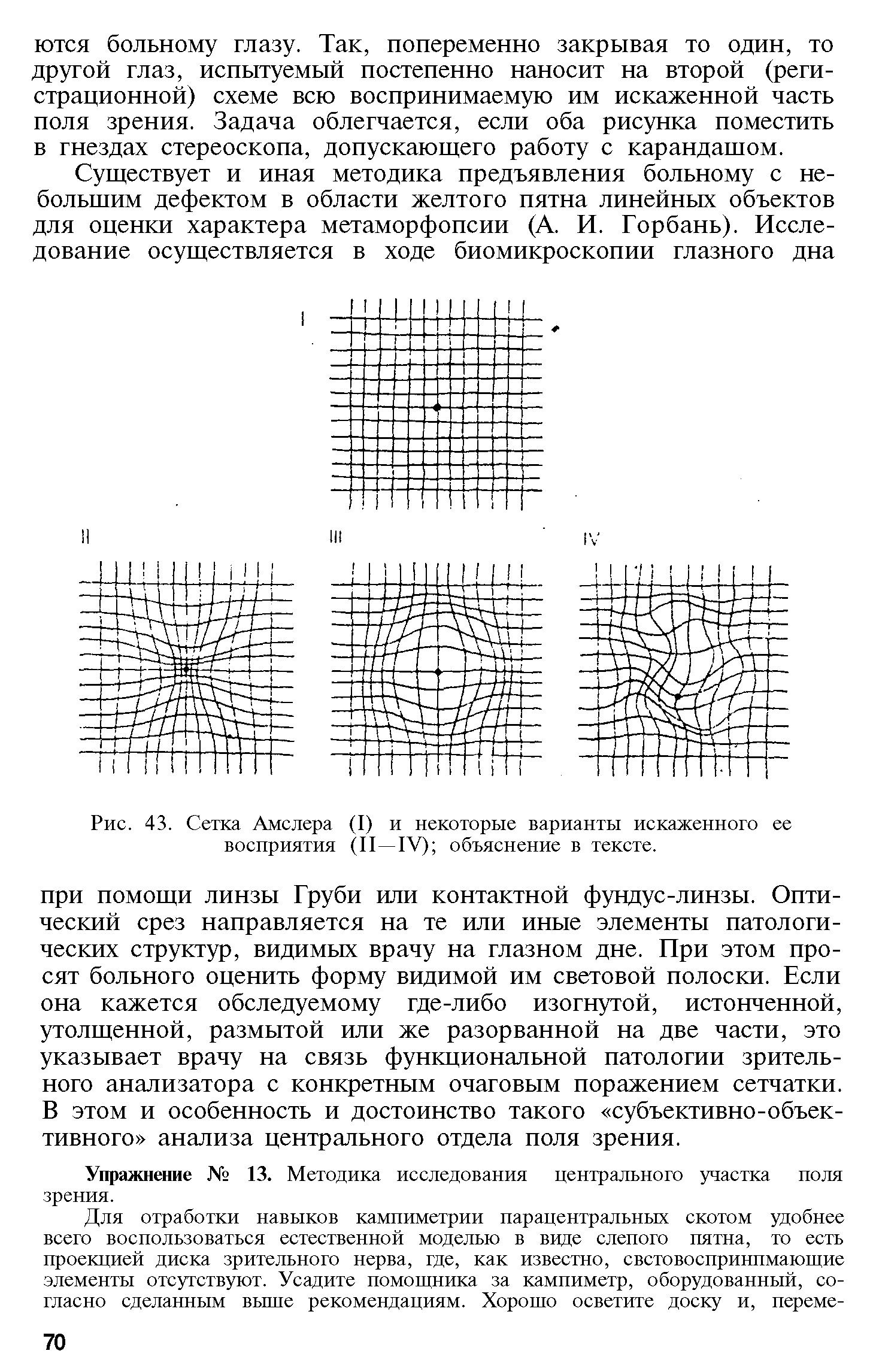Рис. 43. Сетка Амслера (I) и некоторые варианты искаженного ее восприятия (II—IV) объяснение в тексте.