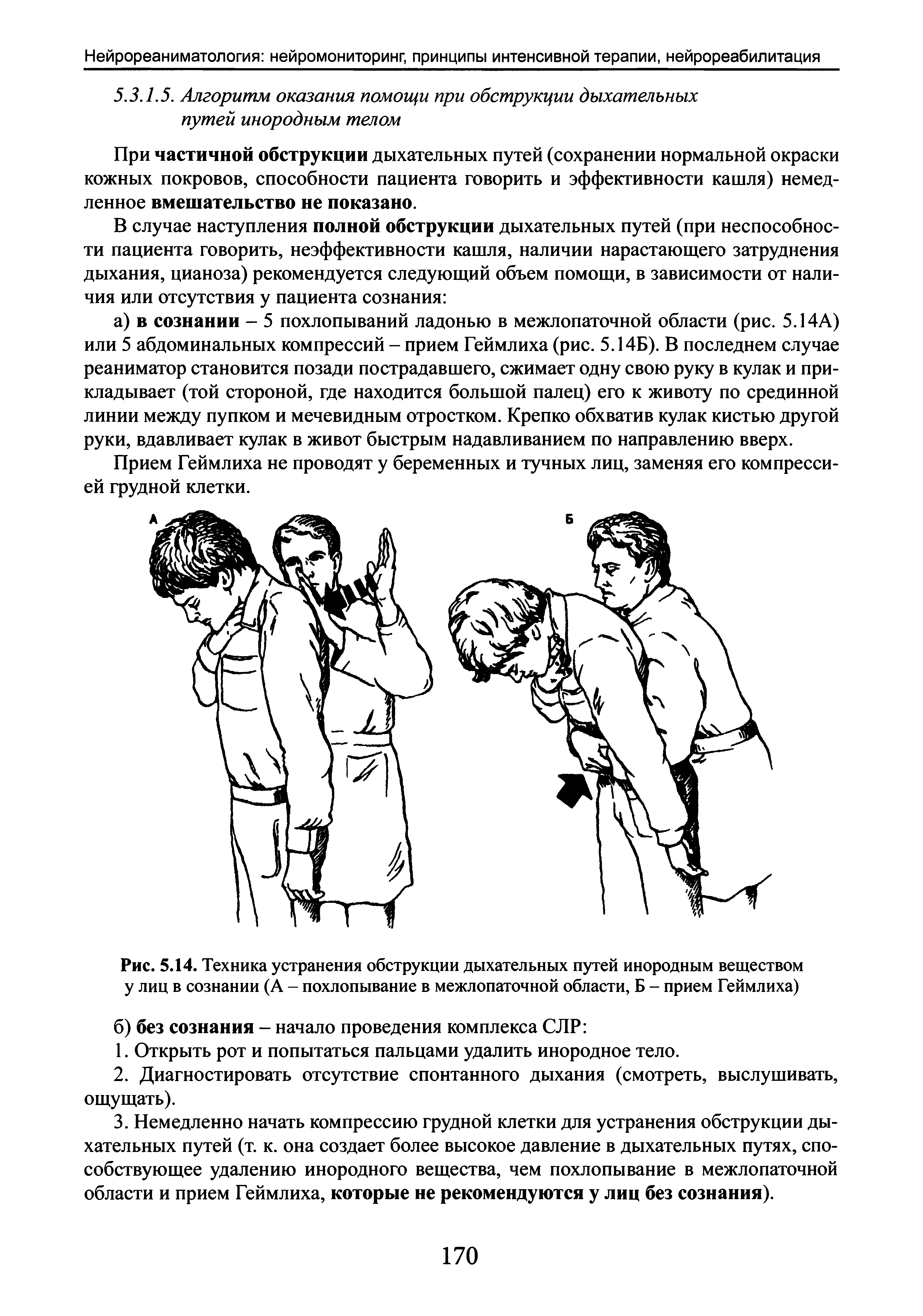 Рис. 5.14. Техника устранения обструкции дыхательных путей инородным веществом у лиц в сознании (А - похлопывание в межлопаточной области, Б - прием Геймлиха)...