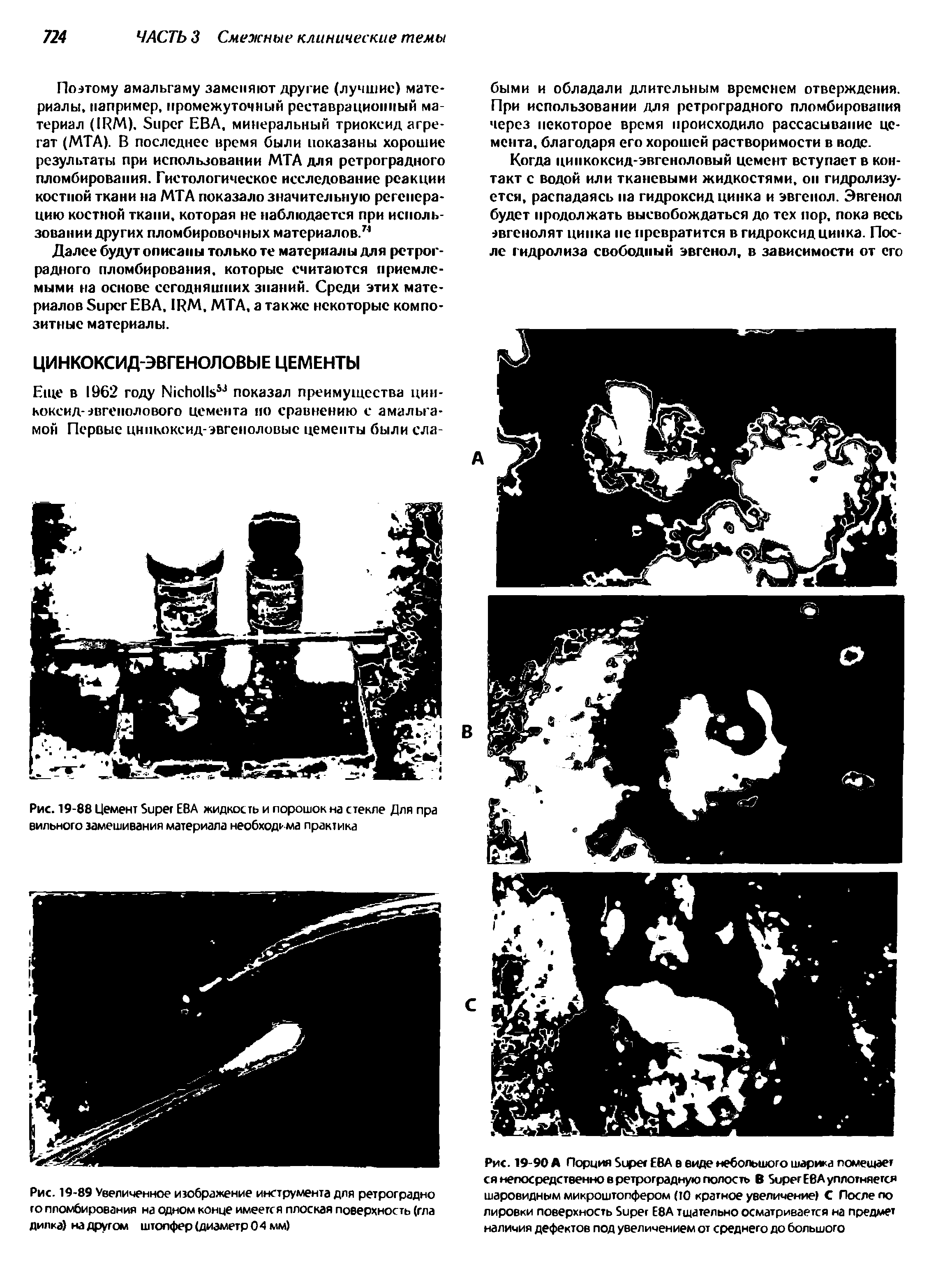 Рис. 19-88 Цемент S ЕВА жидкость и порошок на стекле Для пра вильного замешивания материала необходима практика...