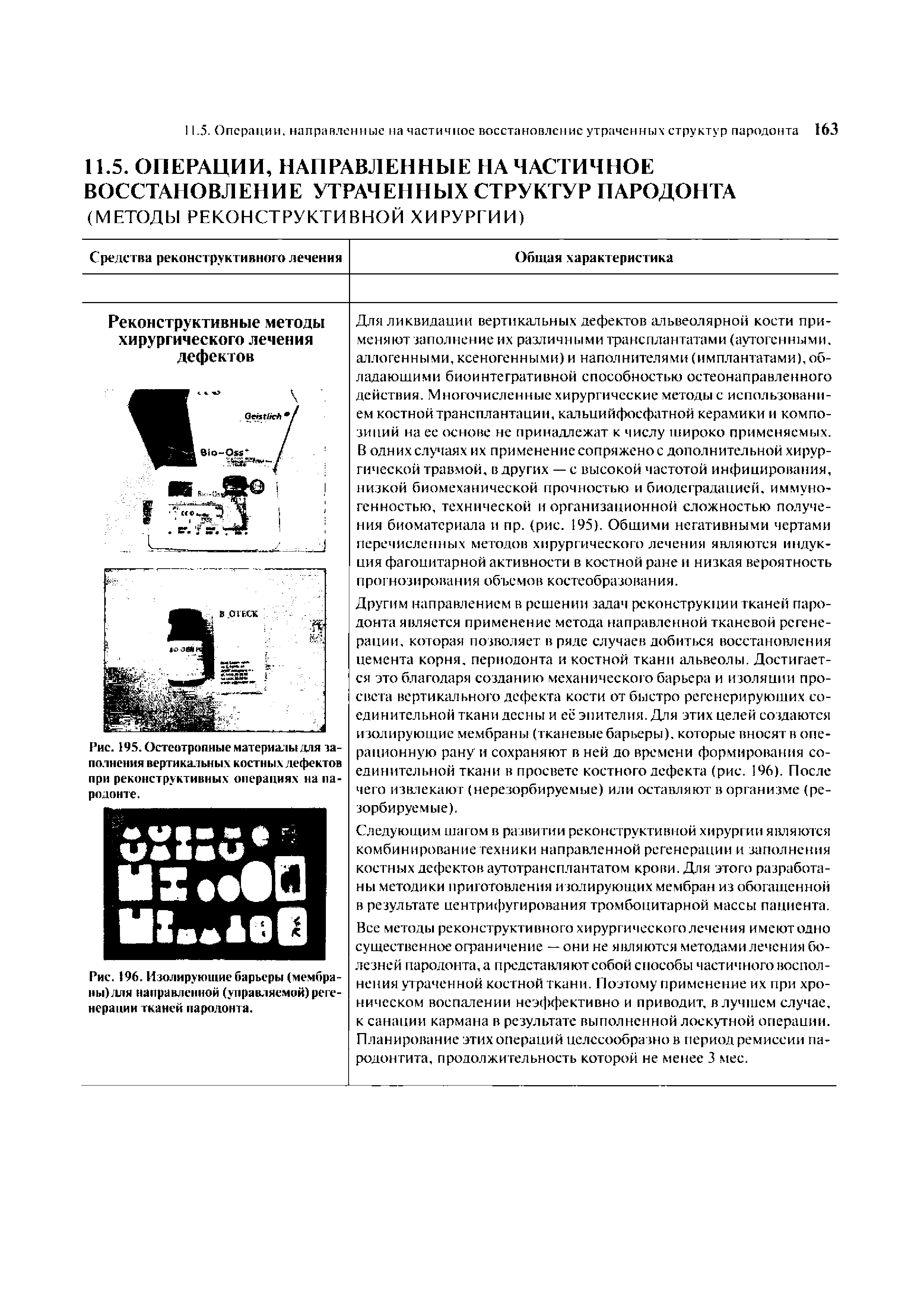 Рис. 196. Изолирующие барьеры (мембраны) для направленной (управляемой) регенерации тканей пародонта.