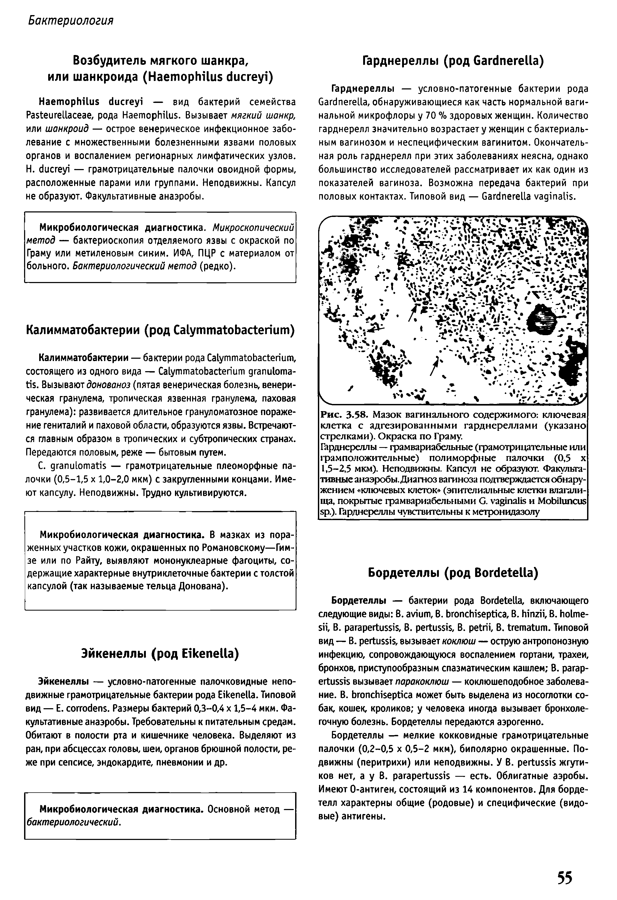 Рис. 3.58. Мазок вагинального содержимого ключевая клетка с адгезированными гарднереллами (указано стрелками). Окраска по Граму.