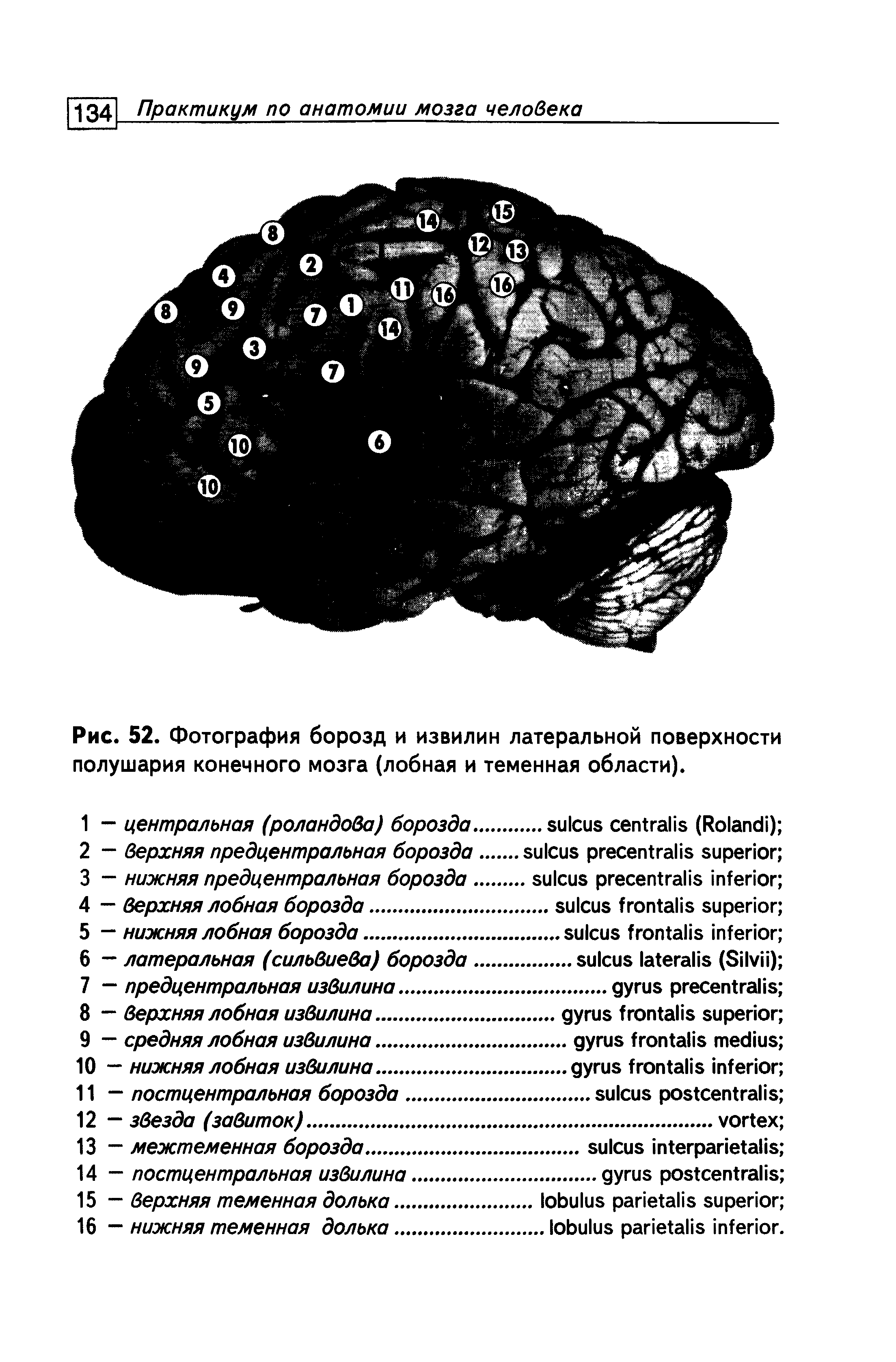 Рис. 52. Фотография борозд и извилин латеральной поверхности полушария конечного мозга (лобная и теменная области).