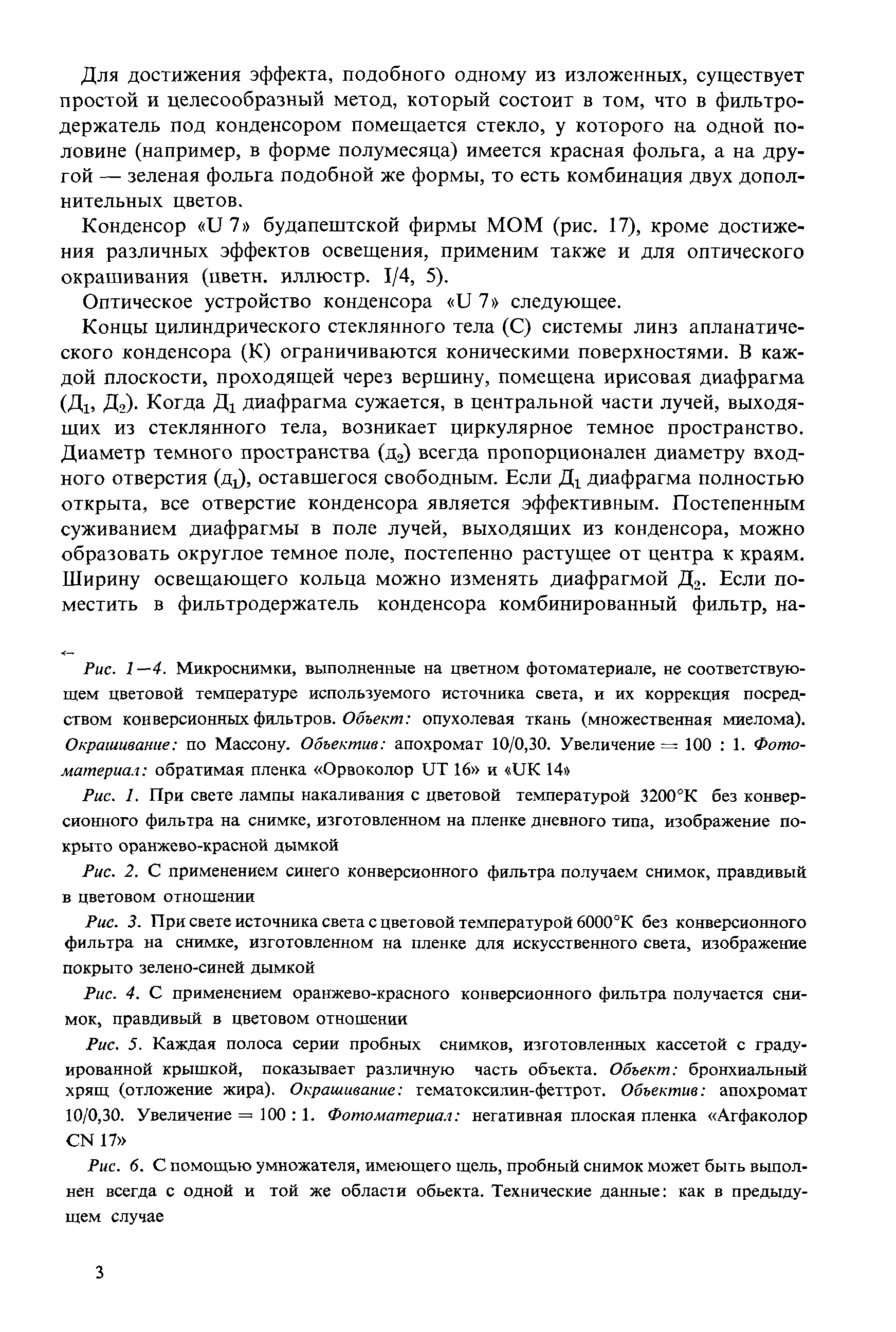 Рис. 5. Каждая полоса серии пробных снимков, изготовленных кассетой с градуированной крышкой, показывает различную часть объекта. Объект бронхиальный хрящ (отложение жира). Окрашивание гематоксилин-феттрот. Объектив апохромат 10/0,30. Увеличение = 100 1. Фотоматериал негативная плоская пленка Агфаколор СИ 17 ...