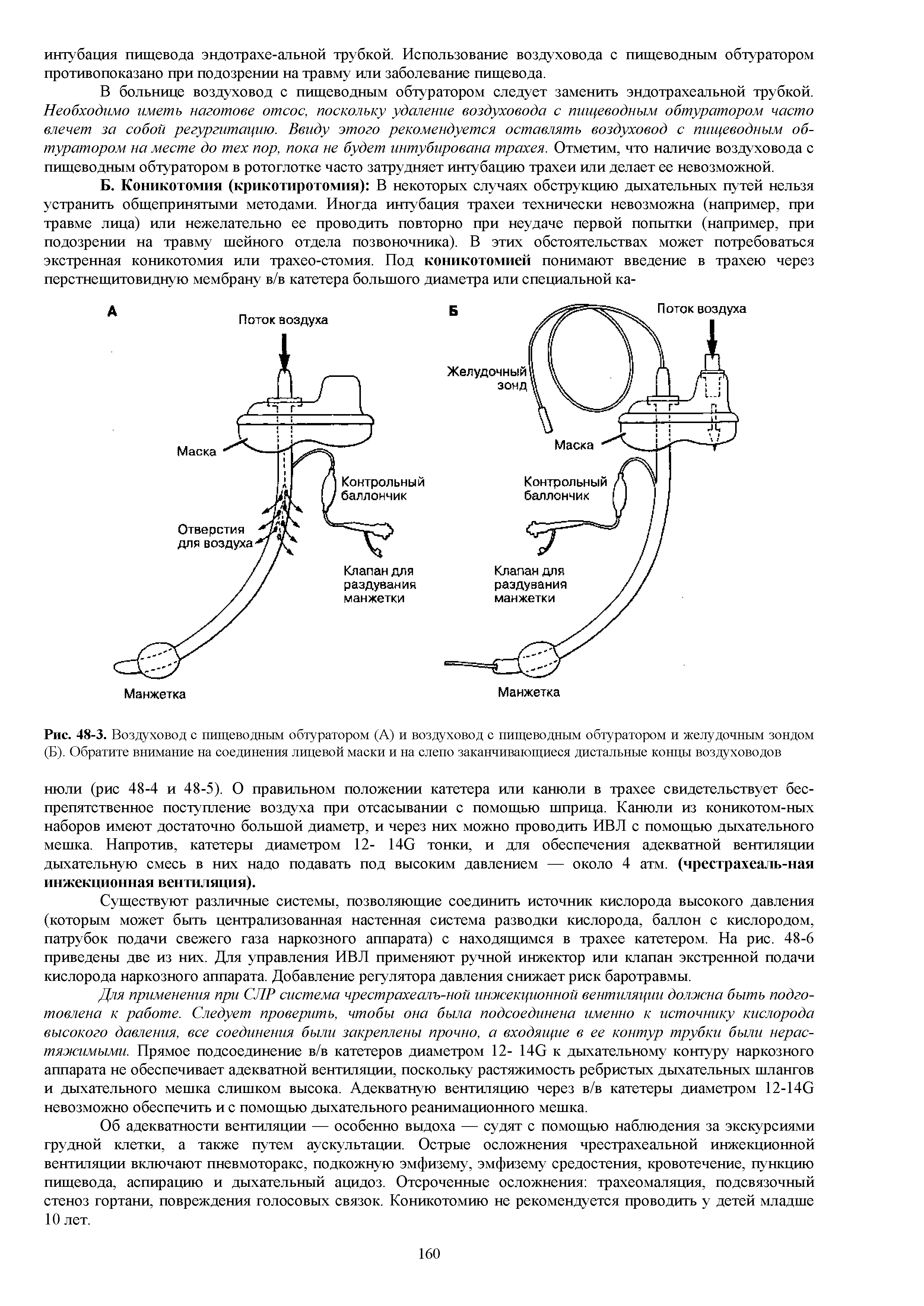 Рис. 48-3. Воздуховод с пищеводным обтуратором (А) и воздуховод с пищеводным обтуратором и желудочным зондом (Б). Обратите внимание на соединения лицевой маски и на слепо заканчивающиеся дистальные концы воздуховодов...
