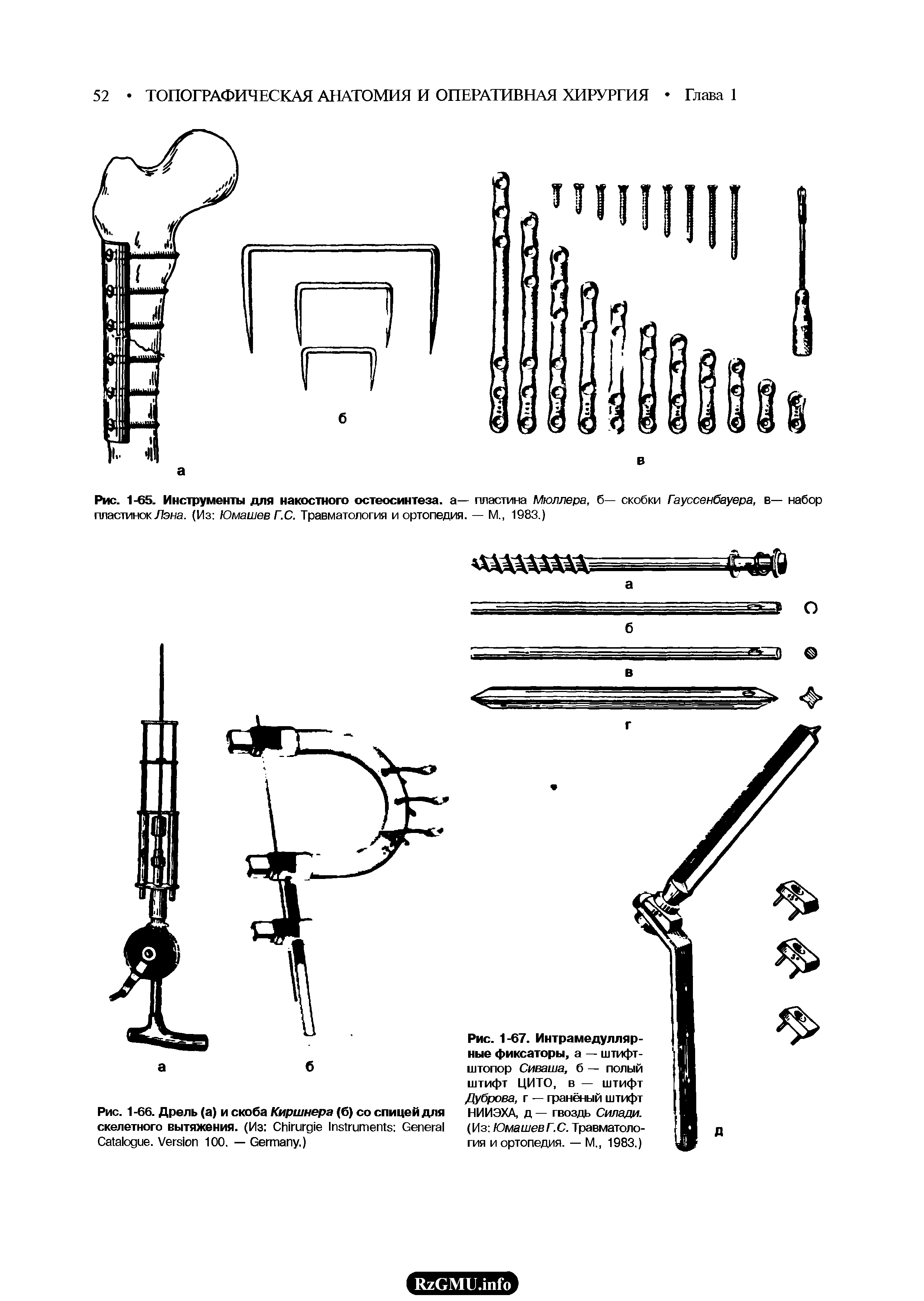 Рис. 1-67. Интрамедуллярные фиксаторы, а — штифт-штопор Сиваша, б — полый штифт ЦИТО, в — штифт Дуброва, г — гранёный штифт НИИЭХА, д — гвоздь Силади. (Из ЮмашевГ.С. Травматология и ортопедия. — М., 1983.)...