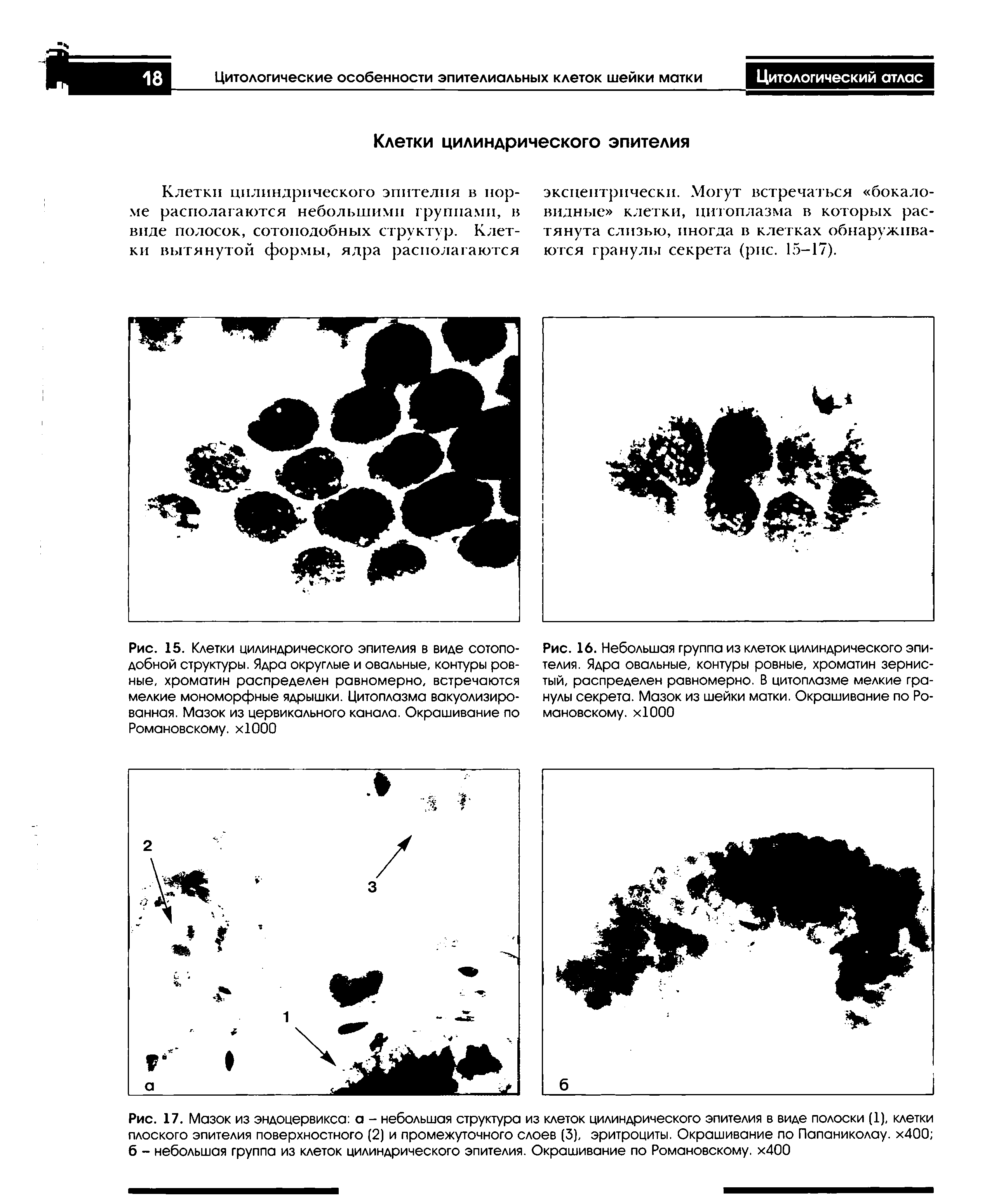 Рис. 17. Мазок из эндоцервикса а - небольшая структура из клеток цилиндрического эпителия в виде полоски (1), клетки плоского эпителия поверхностного (2) и промежуточного слоев (3), эритроциты. Окрашивание по Папаниколау. х400 б - небольшая группа из клеток цилиндрического эпителия. Окрашивание по Романовскому. х400...