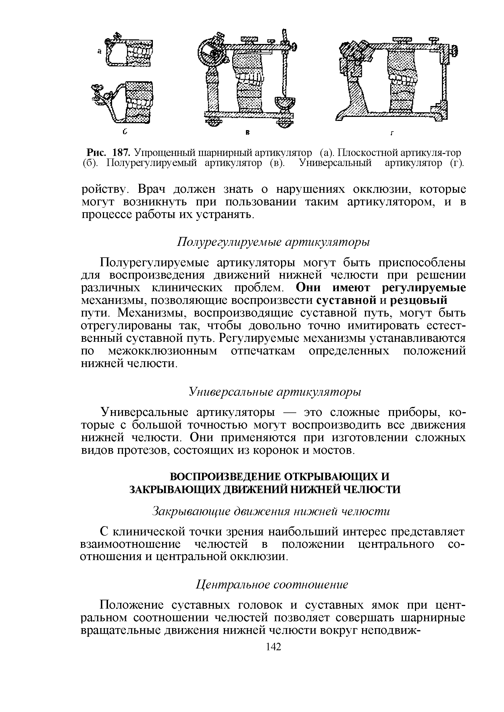 Рис. 187. Упрощенный шарнирный артикулятор (а). Плоскостной артикуля-тор (б). Полу регулируемый артикулятор (в). Универсальный артикулятор (г).