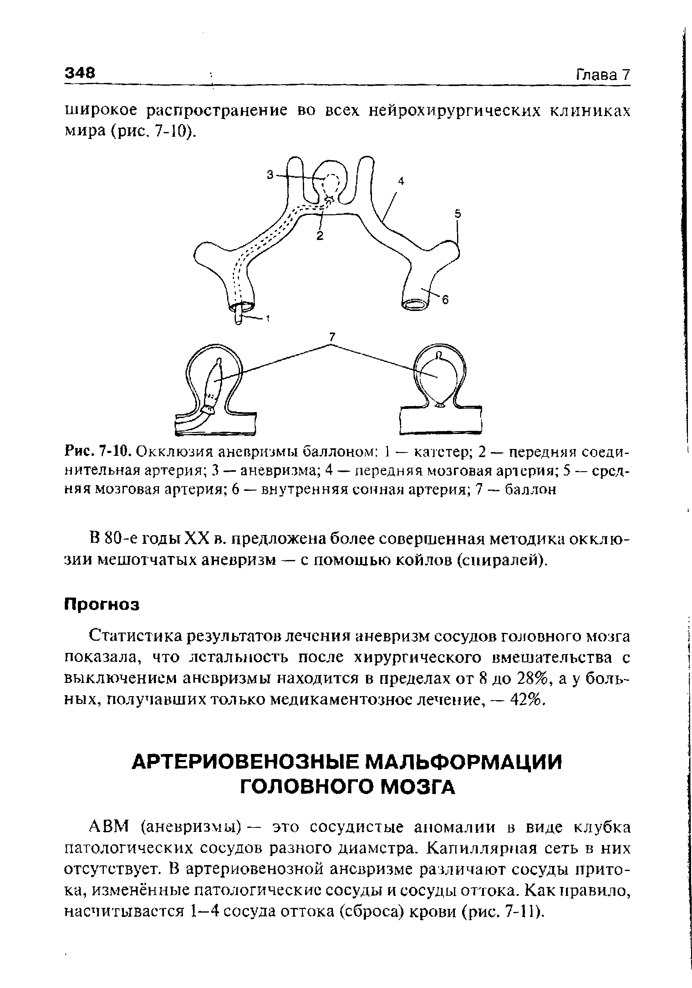 Рис. 7-10. Окклюзия аневризмы баллоном 1 — катетер 2 — передняя соединительная артерия 3 — аневризма 4 — передняя мозговая артерия 5 — средняя мозговая артерия 6 — внутренняя сонная артерия 7 — баллон...