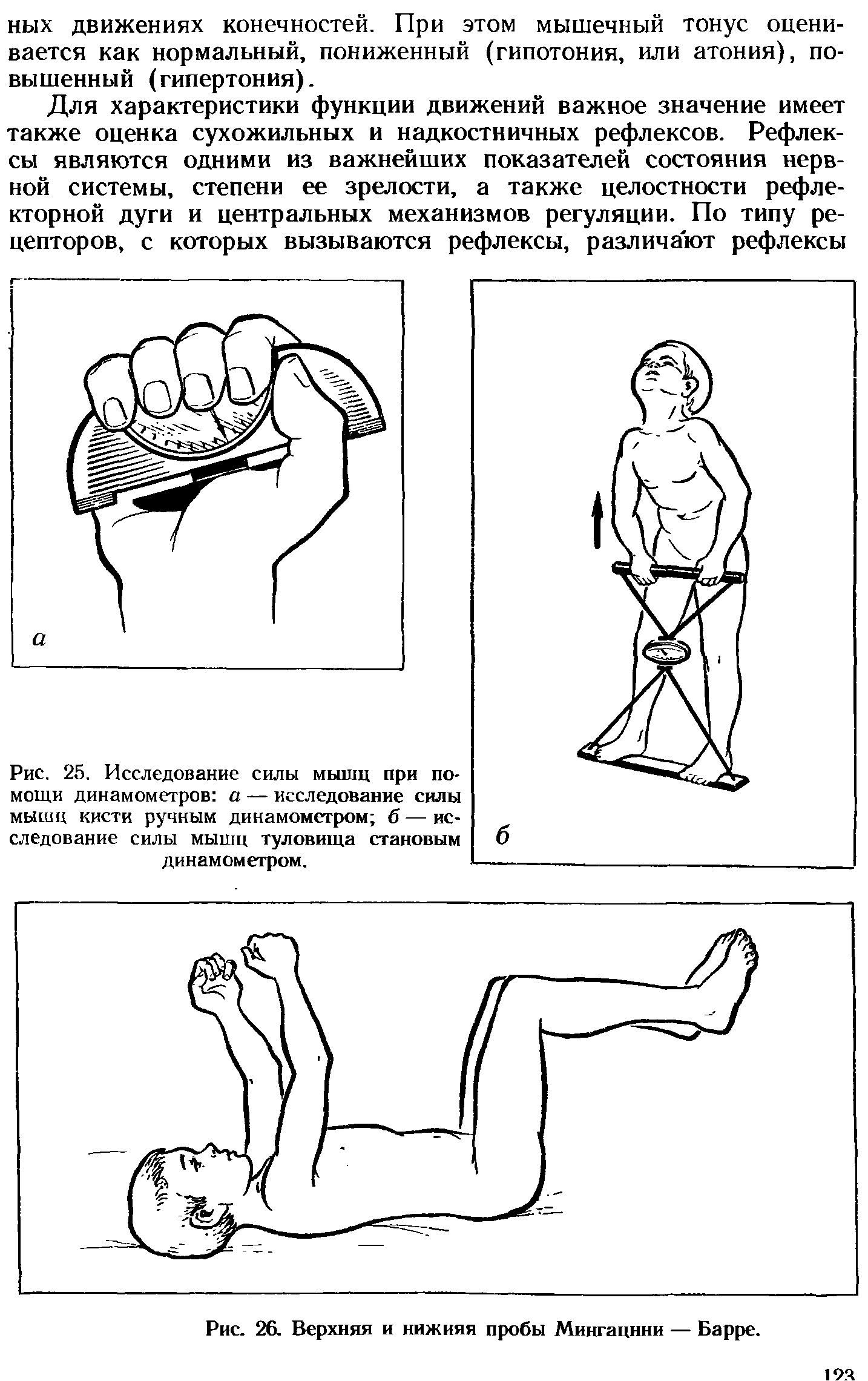 Рис. 25. Исследование силы мышц при помощи динамометров а — исследование силы мышц кисти ручным динамометром б — исследование силы мышц туловища становым динамометром.