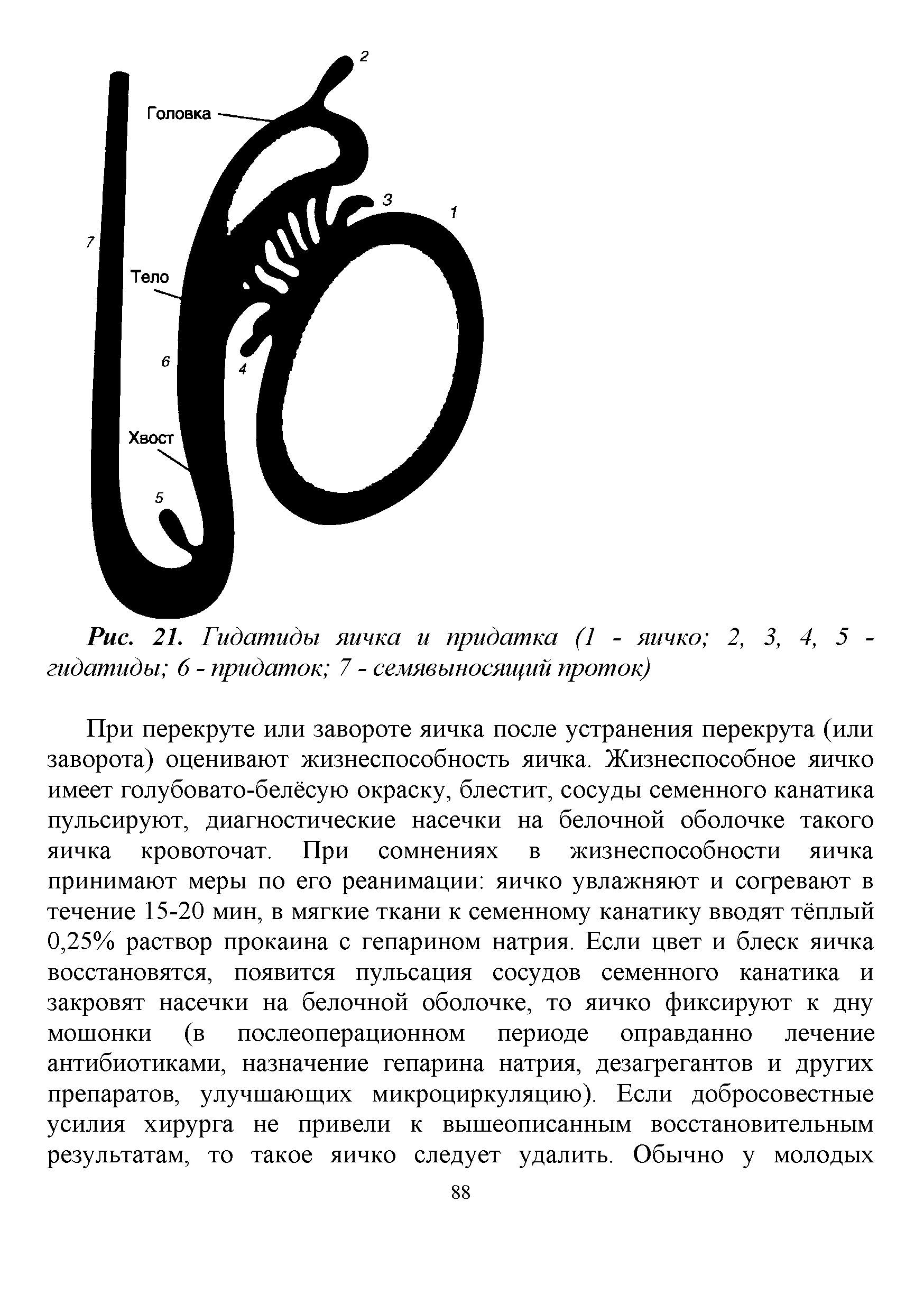 Рис. 21. Гидатиды яичка и придатка (1 - яичко 2, 3, 4, 5 -гидатиды 6 - придаток 7 - семявыносящий проток)...